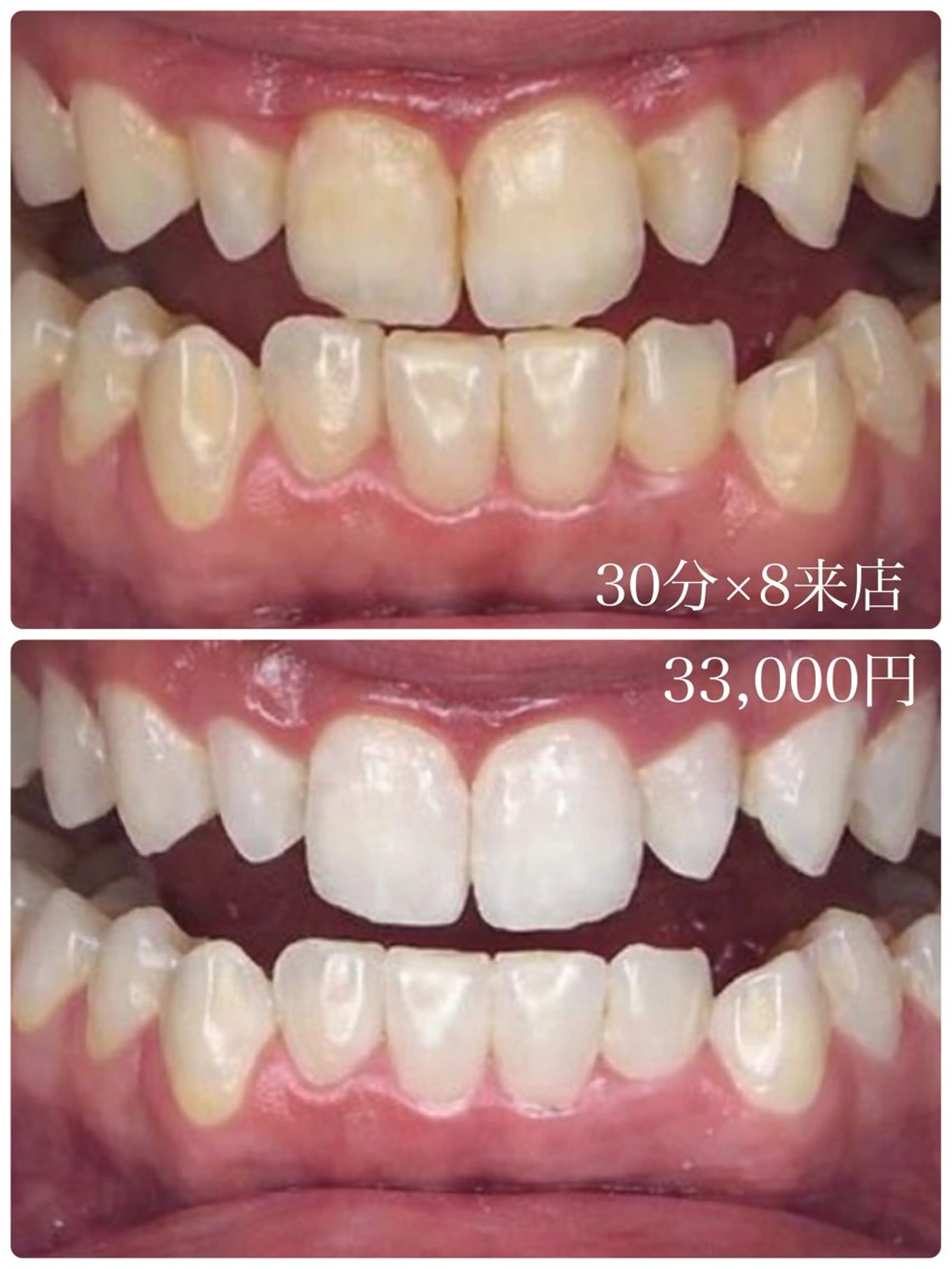 エステ 【歯科提携】柏ホワイ トニングスタイルのその他イメージ