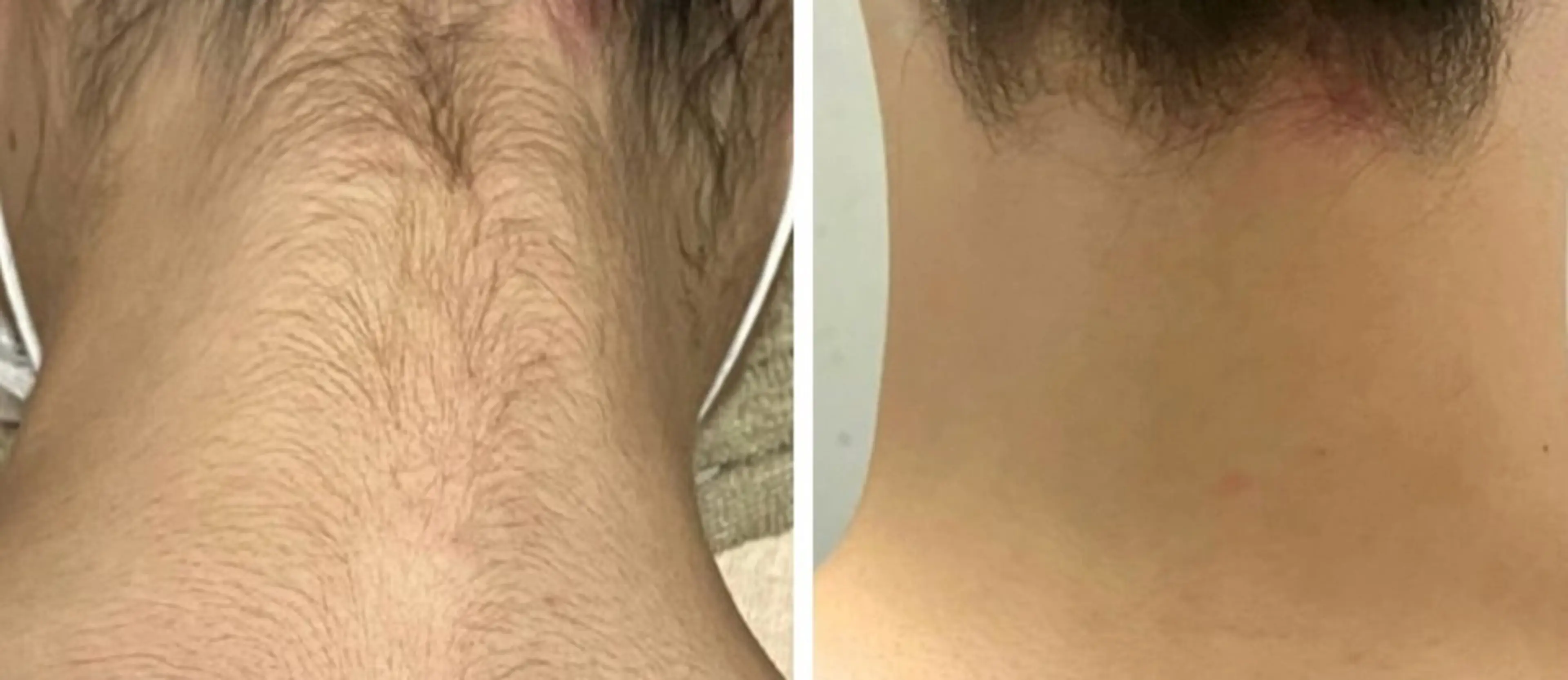 Moonstone 腸活ダイエット・脱毛のエステ・リラクイメージ