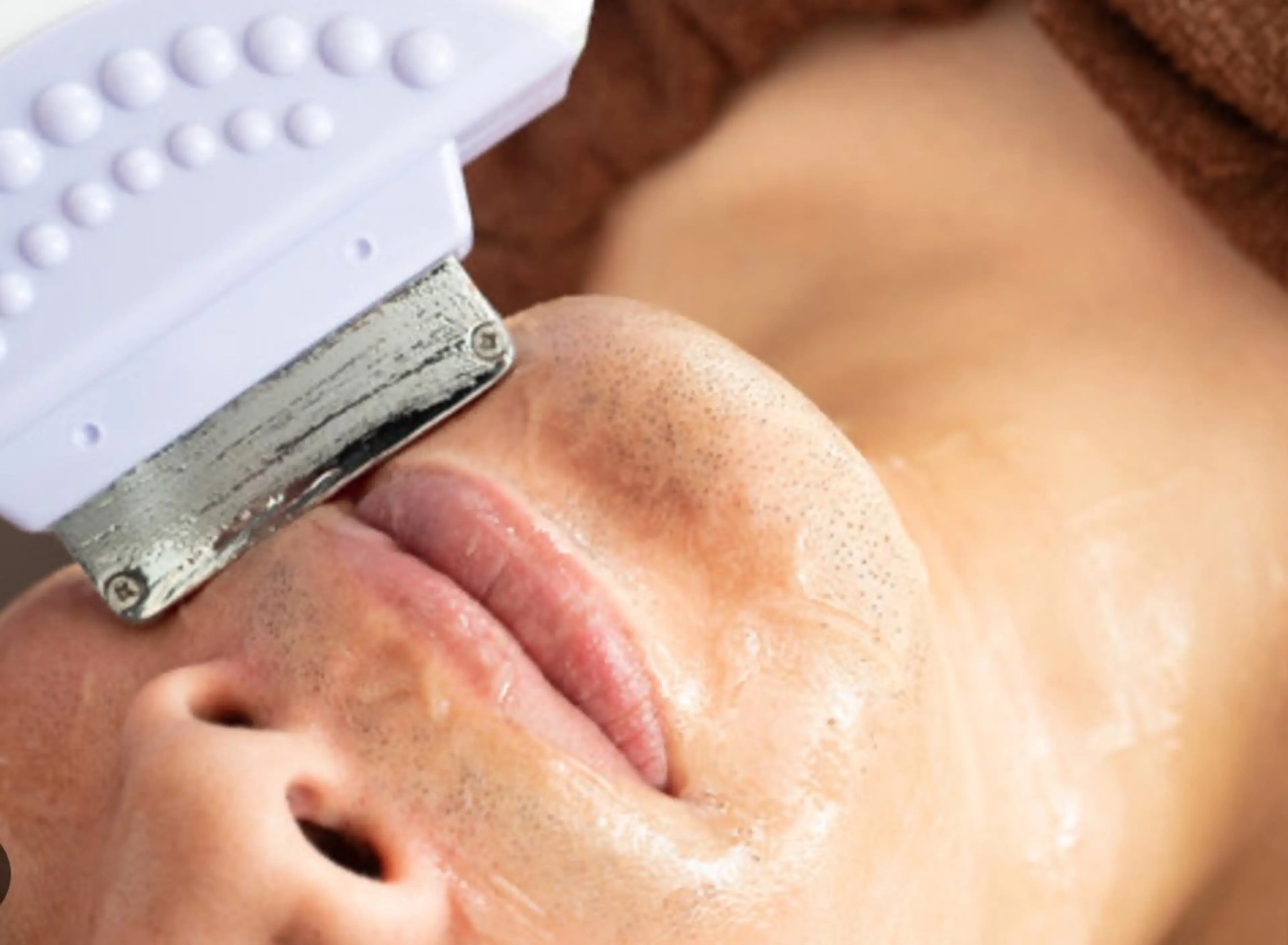 脱毛 脱毛/BBL/SHR PBSサロンAirのエステ・リラクイメージ