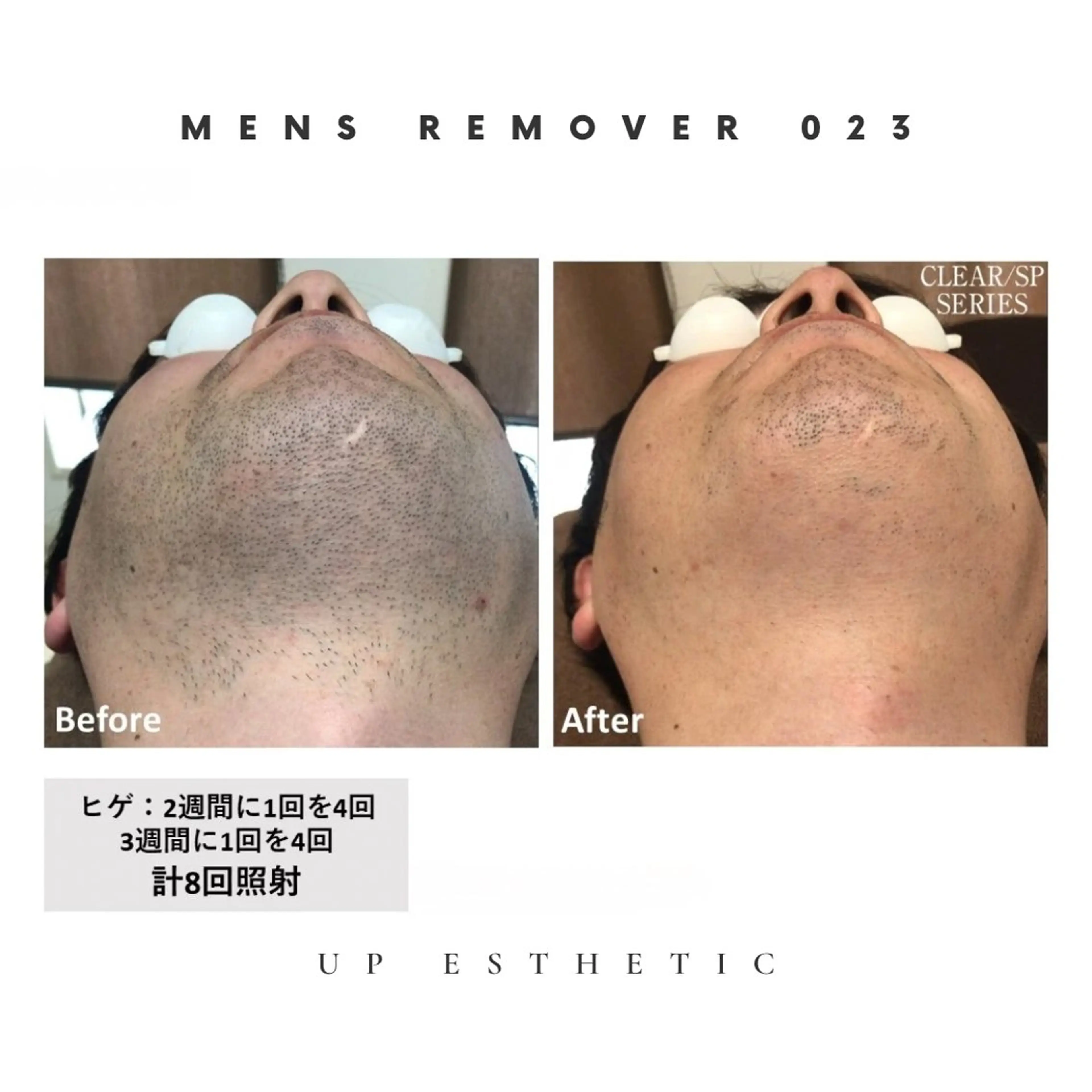 脱毛 ウプエステティック所属・韓国肌管理 ウプエステティックのエステ・リラクイメージ