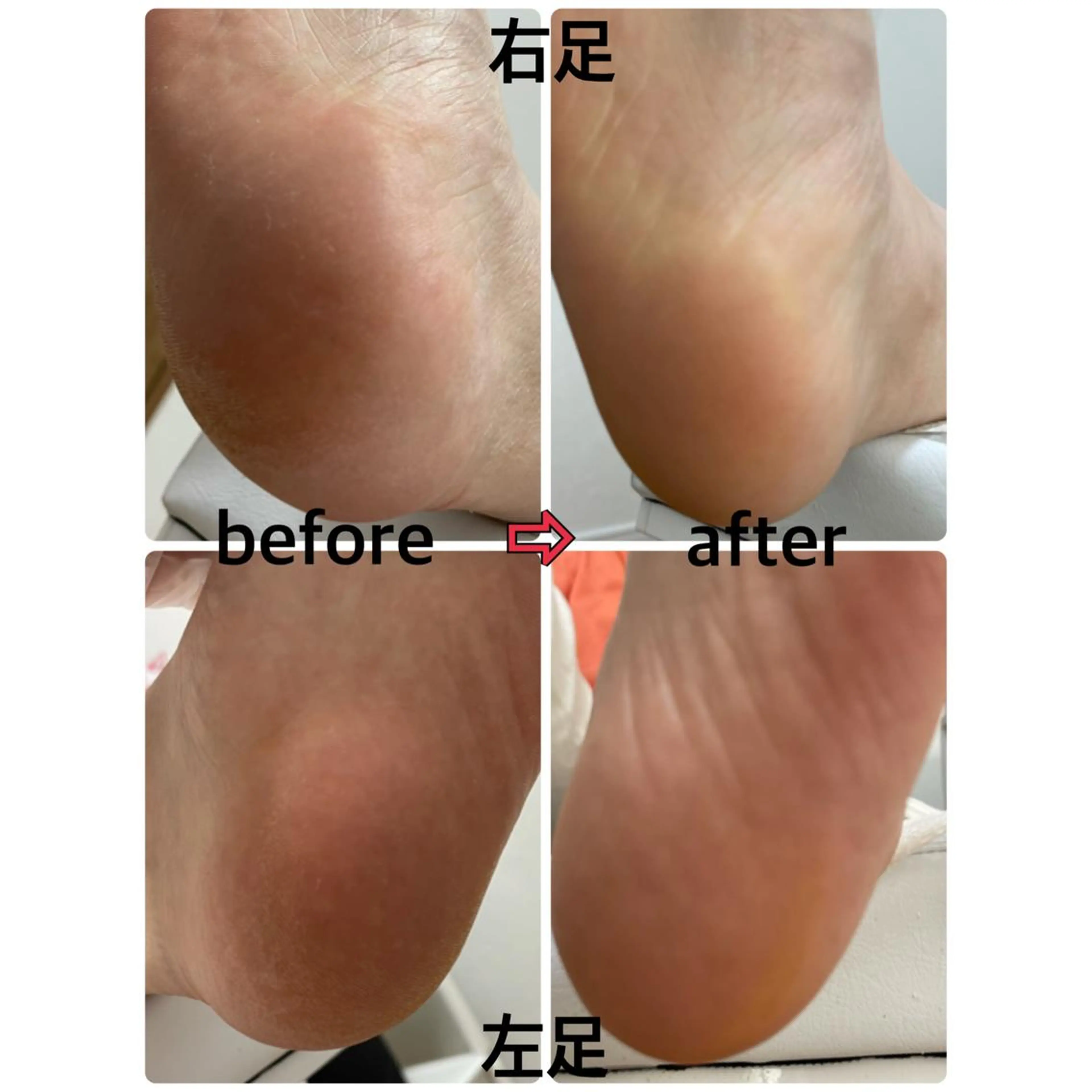 ネイル Nail 331のネイルデザイン