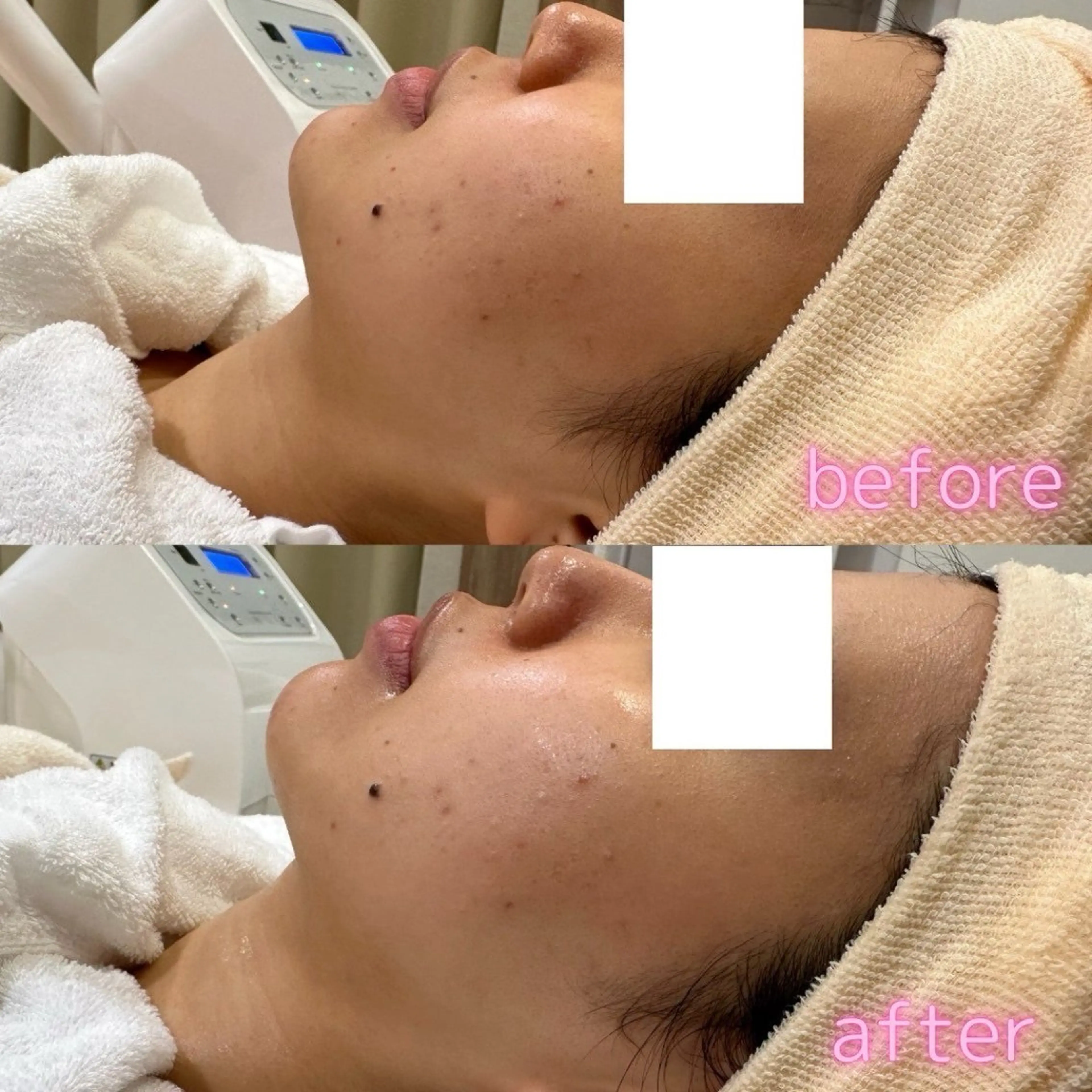 肌質改善美容サロン ému 用賀のエステ・リラクイメージ