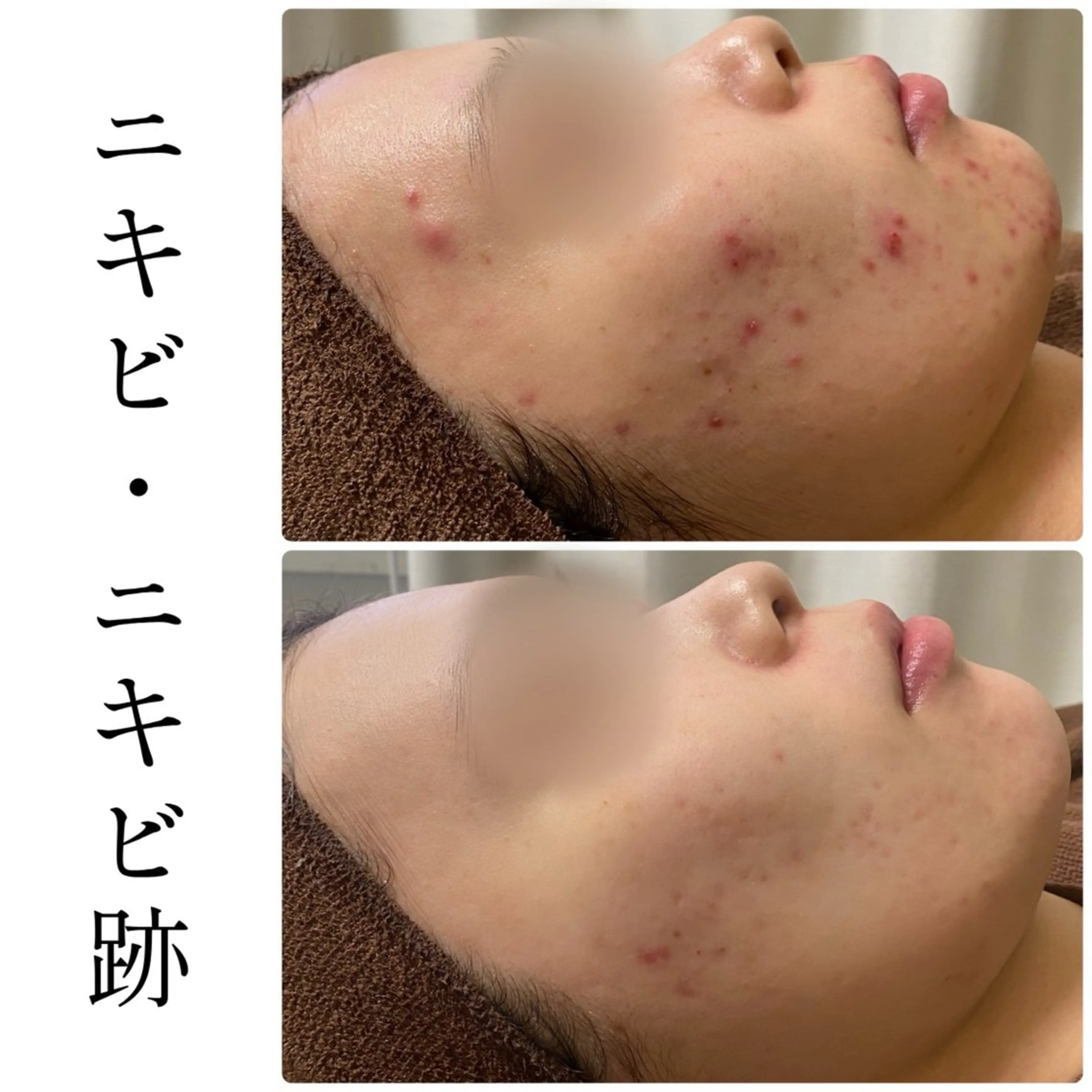 エステ ハーブピーリング専門 BIOEL横浜のエステ・リラクイメージ