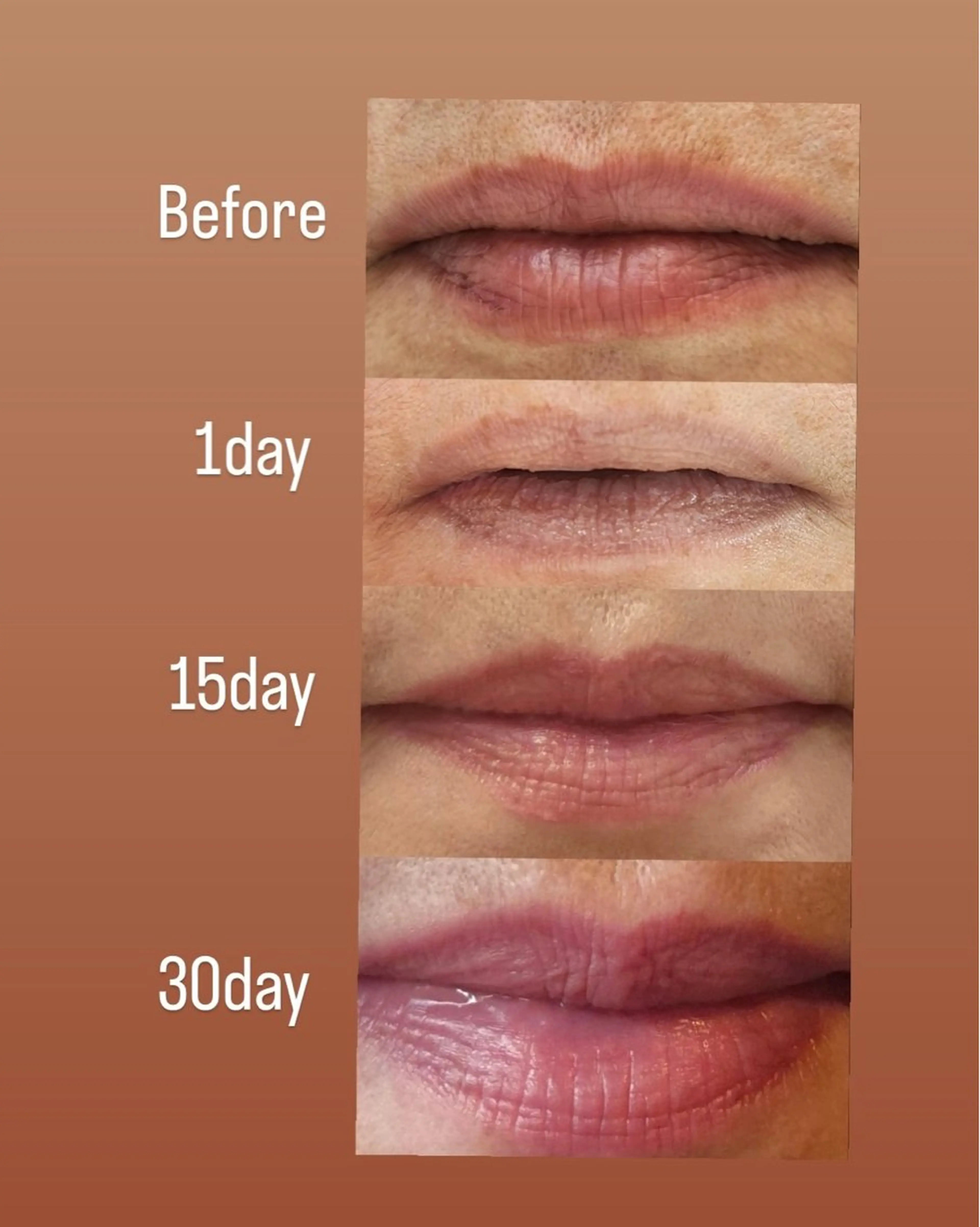 【小顔痩身専門看護師 サロンSONA】のエステ・リラクイメージ