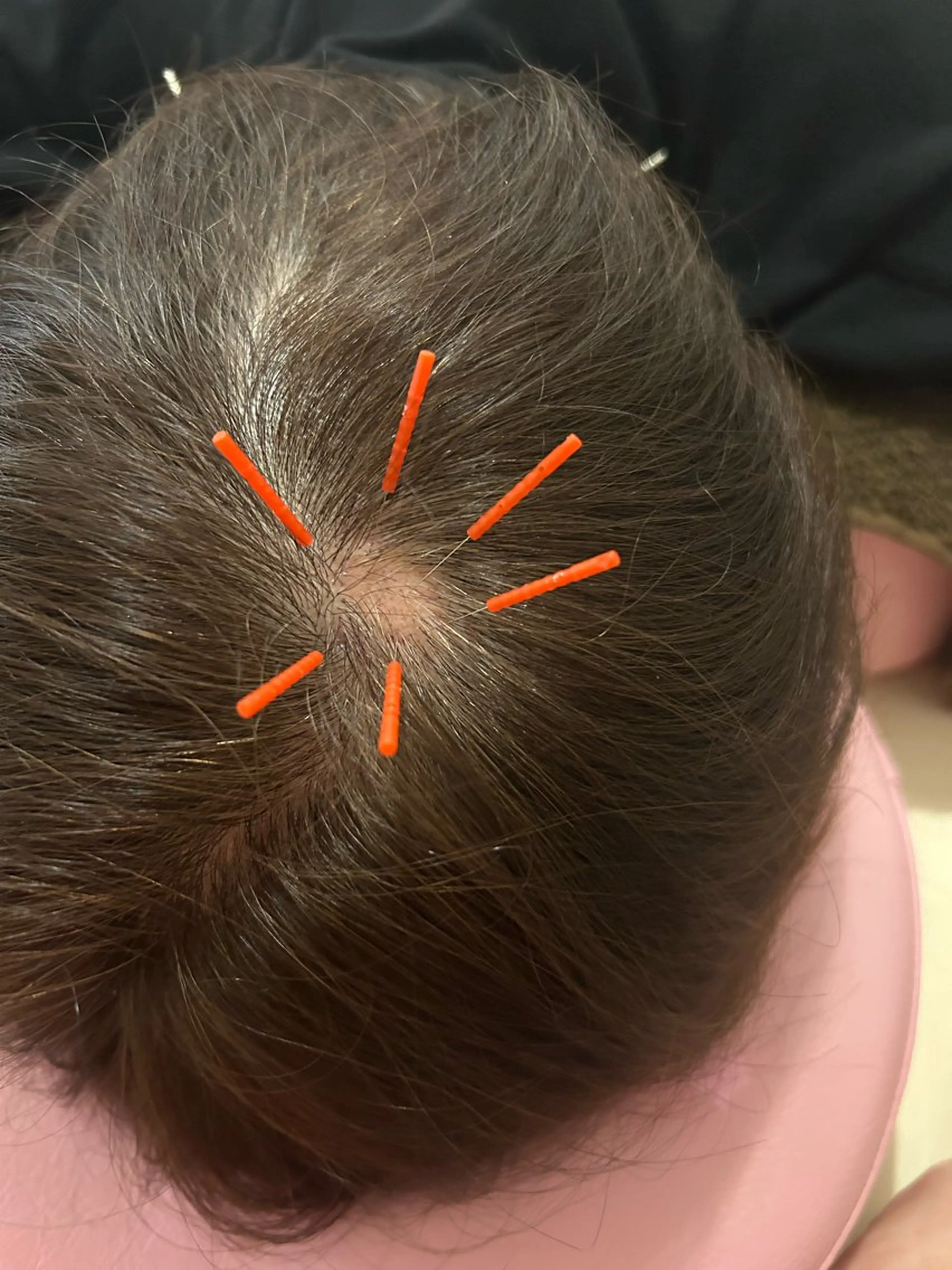 かすがい鍼灸院 Re.heartのエステ・リラクイメージ