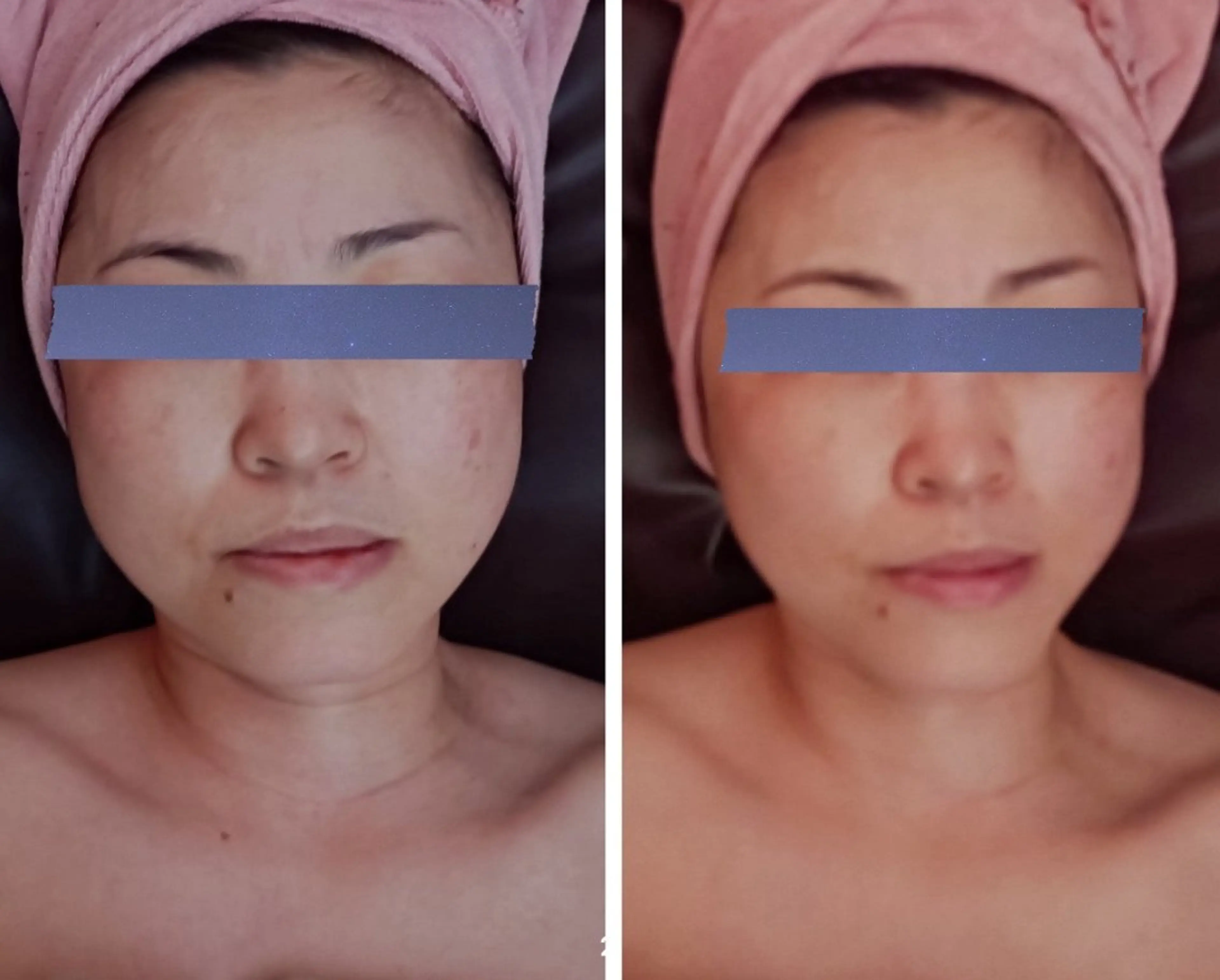 charmant (シャルマン)所属・エステサロン charmantのエステ・リラクイメージ