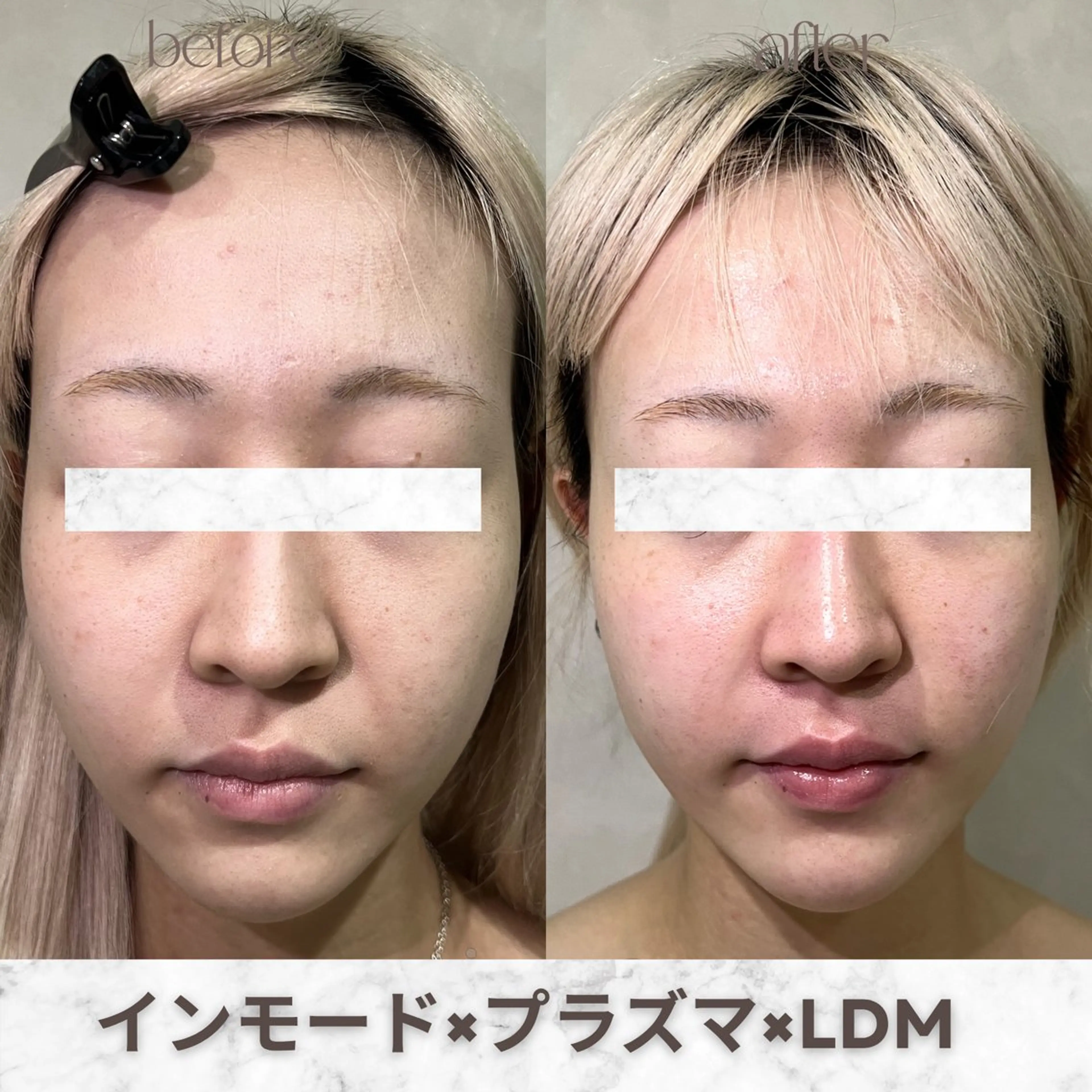 その他 aimer服部 /  小顔 ・ 痩身のその他イメージ