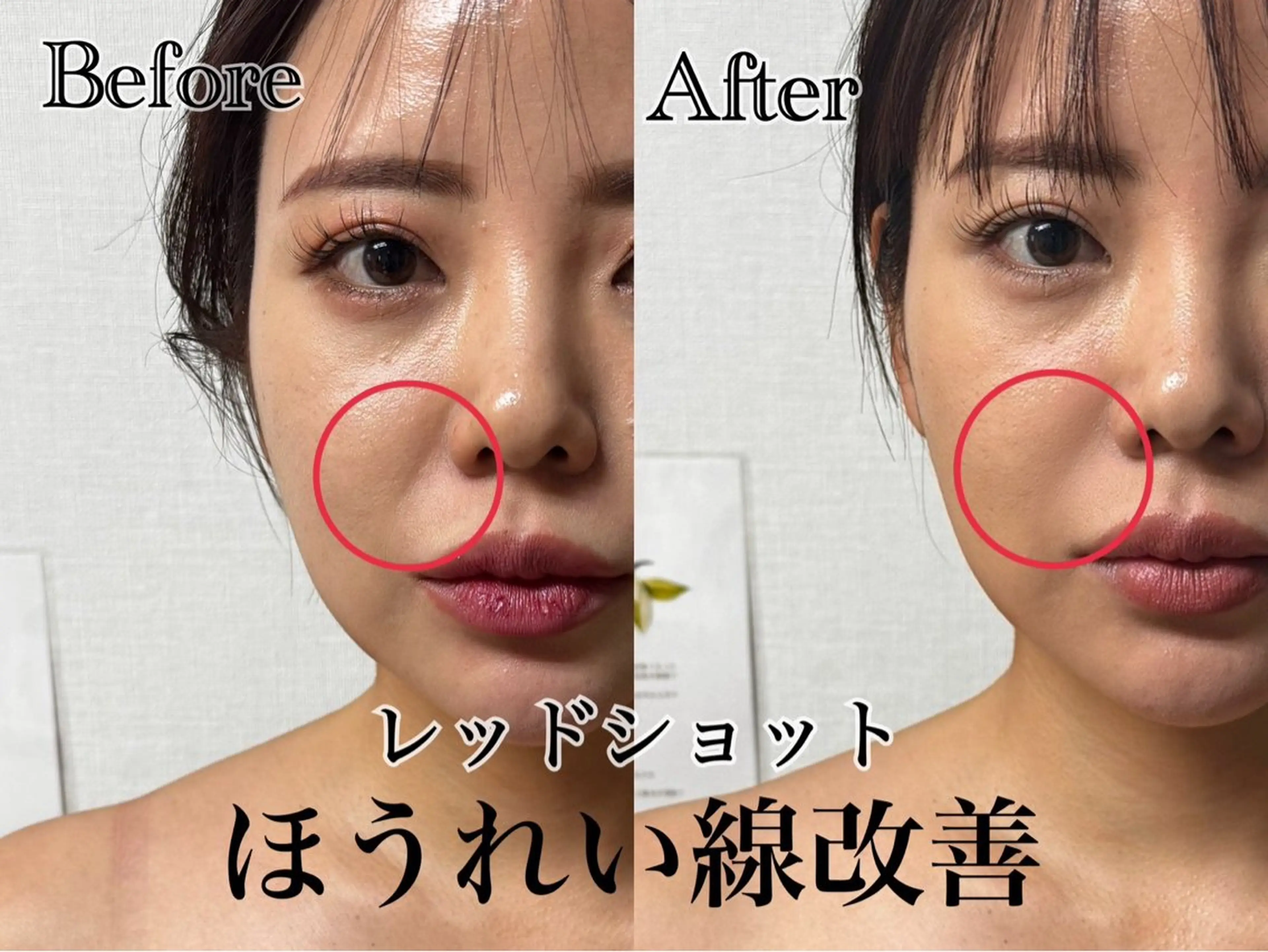 エステ 🌸🧡六本木 脱毛しずか🧡🫧の眉毛・アイブロウイメージ