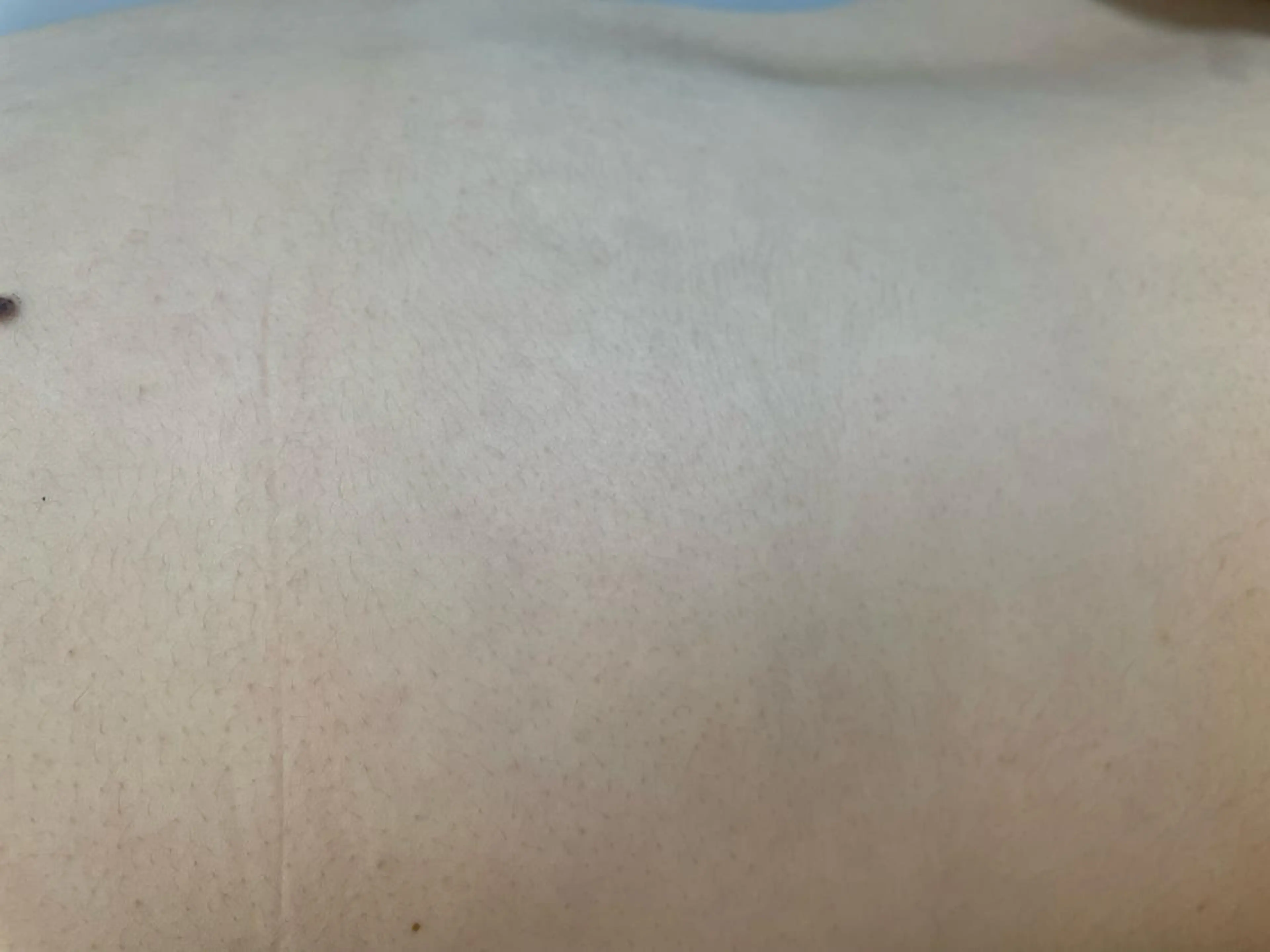 メンズ キッズ 脱毛SALON RaYNiCKのエステ・リラクイメージ