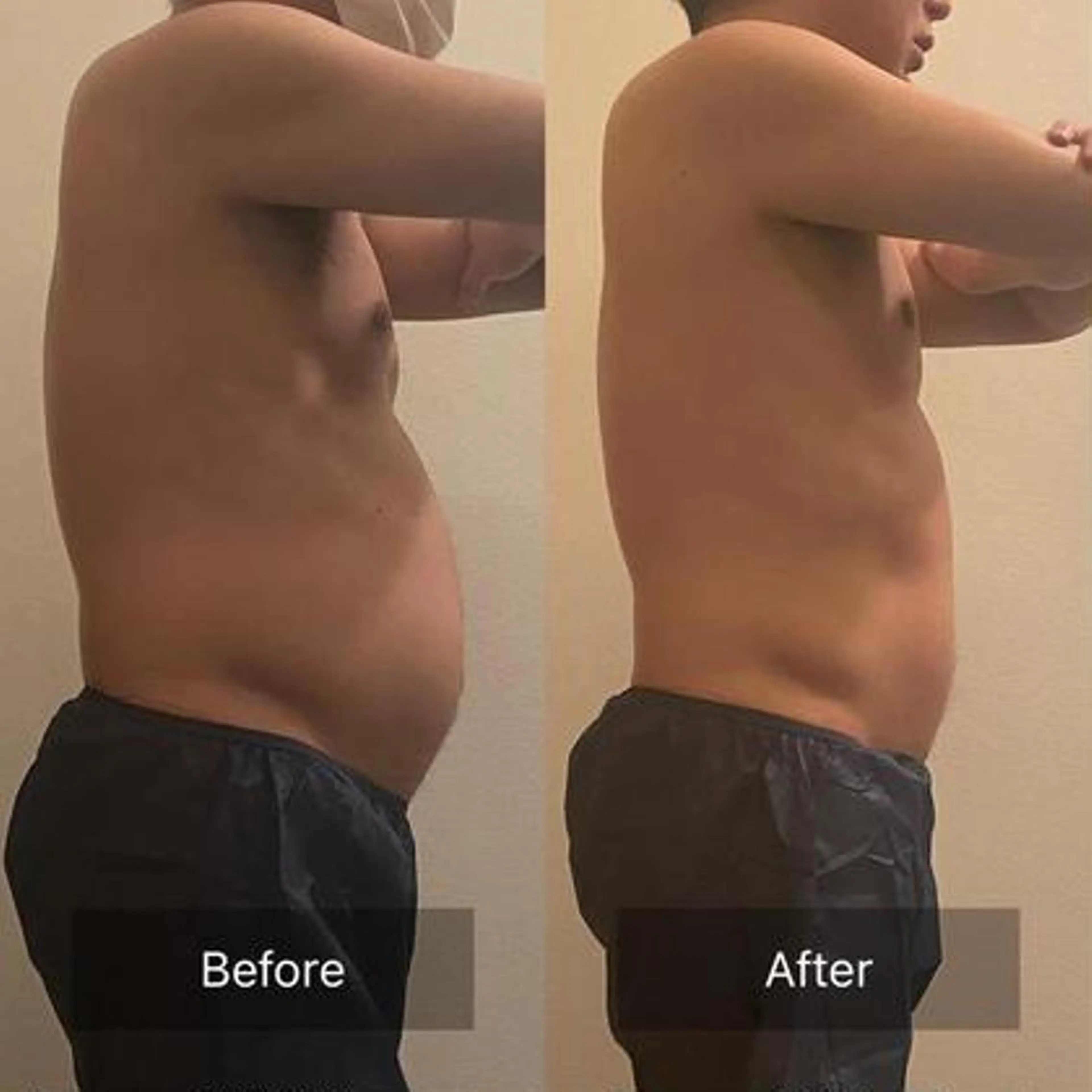 エステ 愛音💜BELZE✮ 肌質改善/痩身のその他イメージ