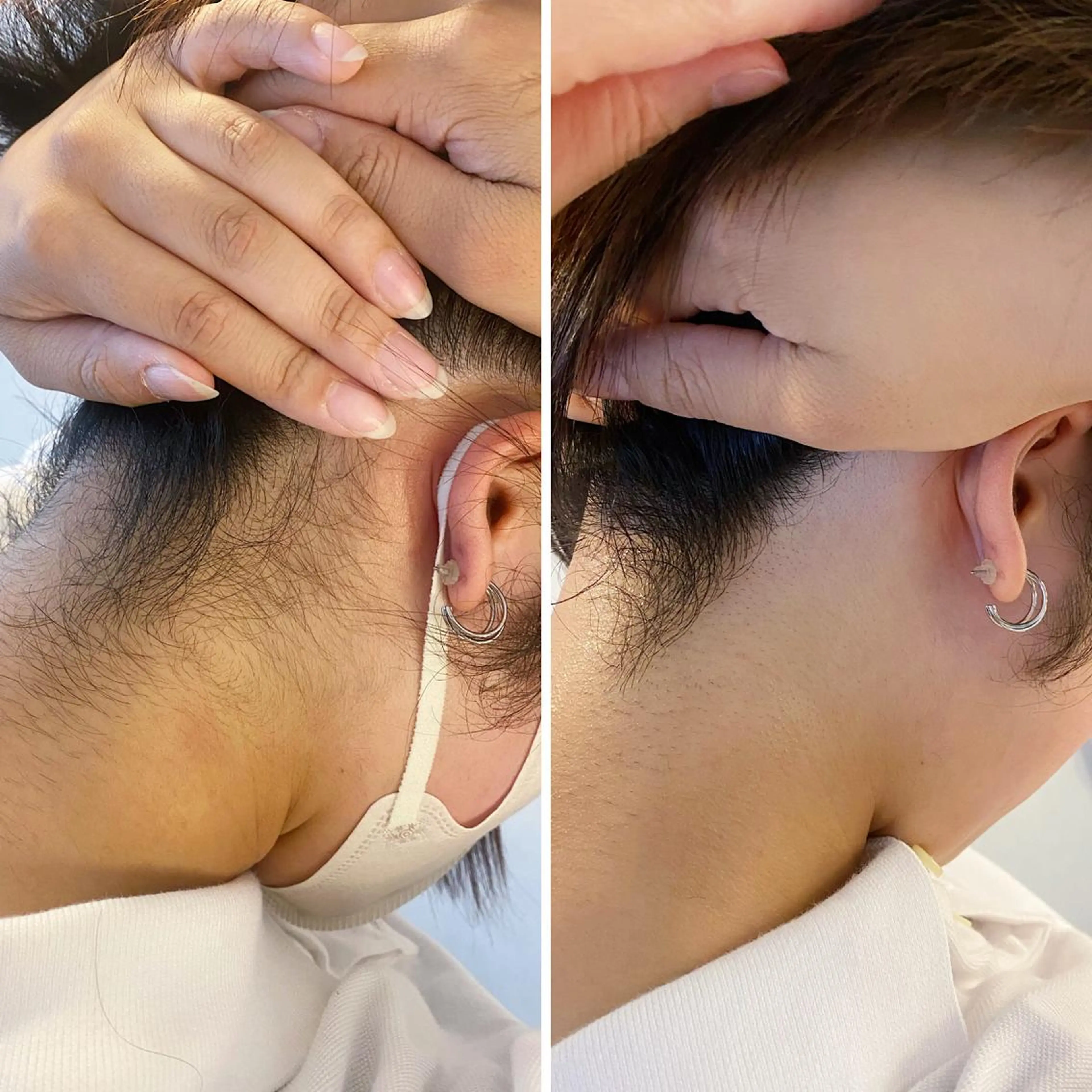 うなじ脱毛/美肌脱毛 LABELのエステ・リラクイメージ