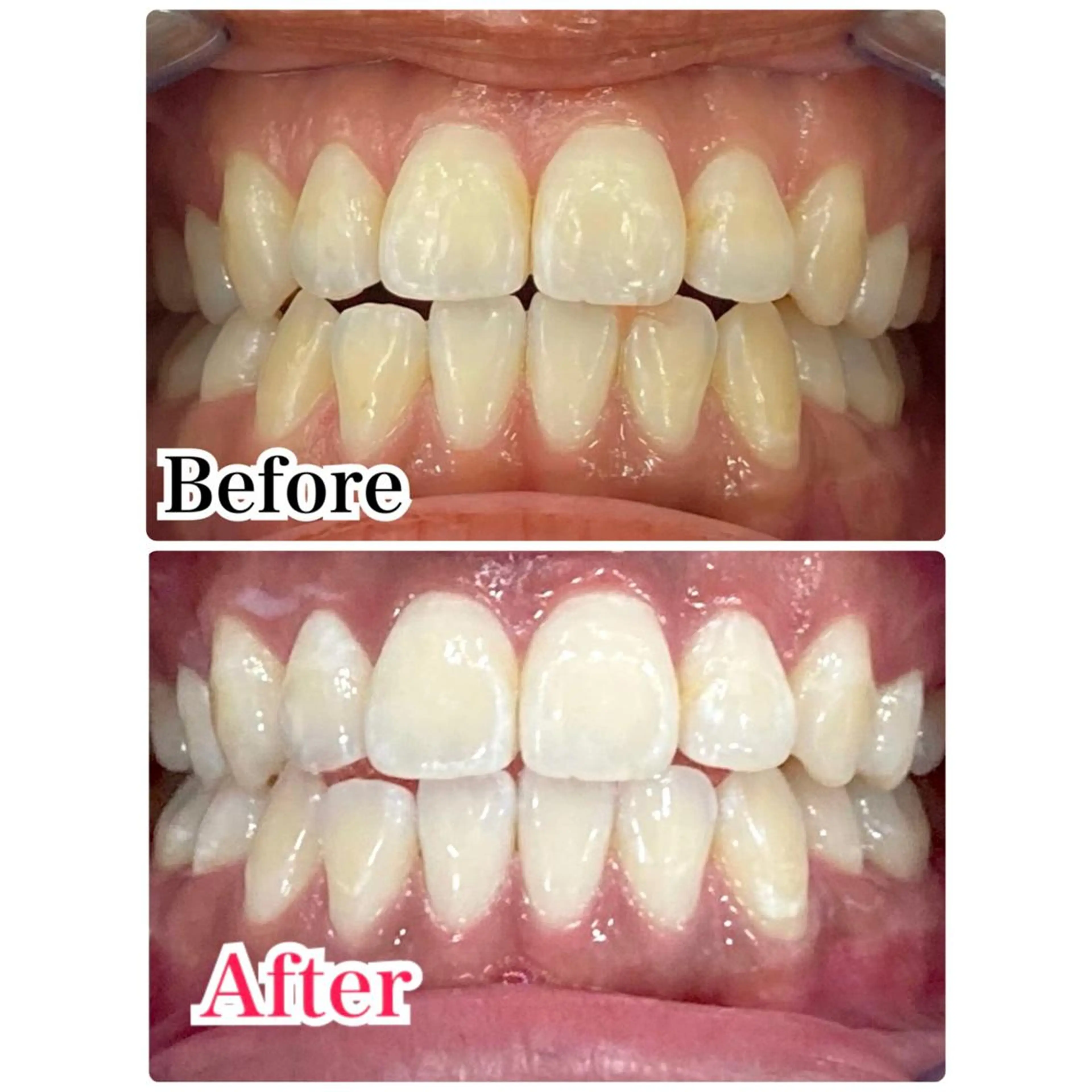 ミディアム カラー パーマ ヘアアレンジ メンズ キッズ ネイル マツエク・マツパ アイブロウ ホワイト プラチナムビューティー柏所属・【歯科提携】柏ホワイ トニングスタイルのその他イメージ