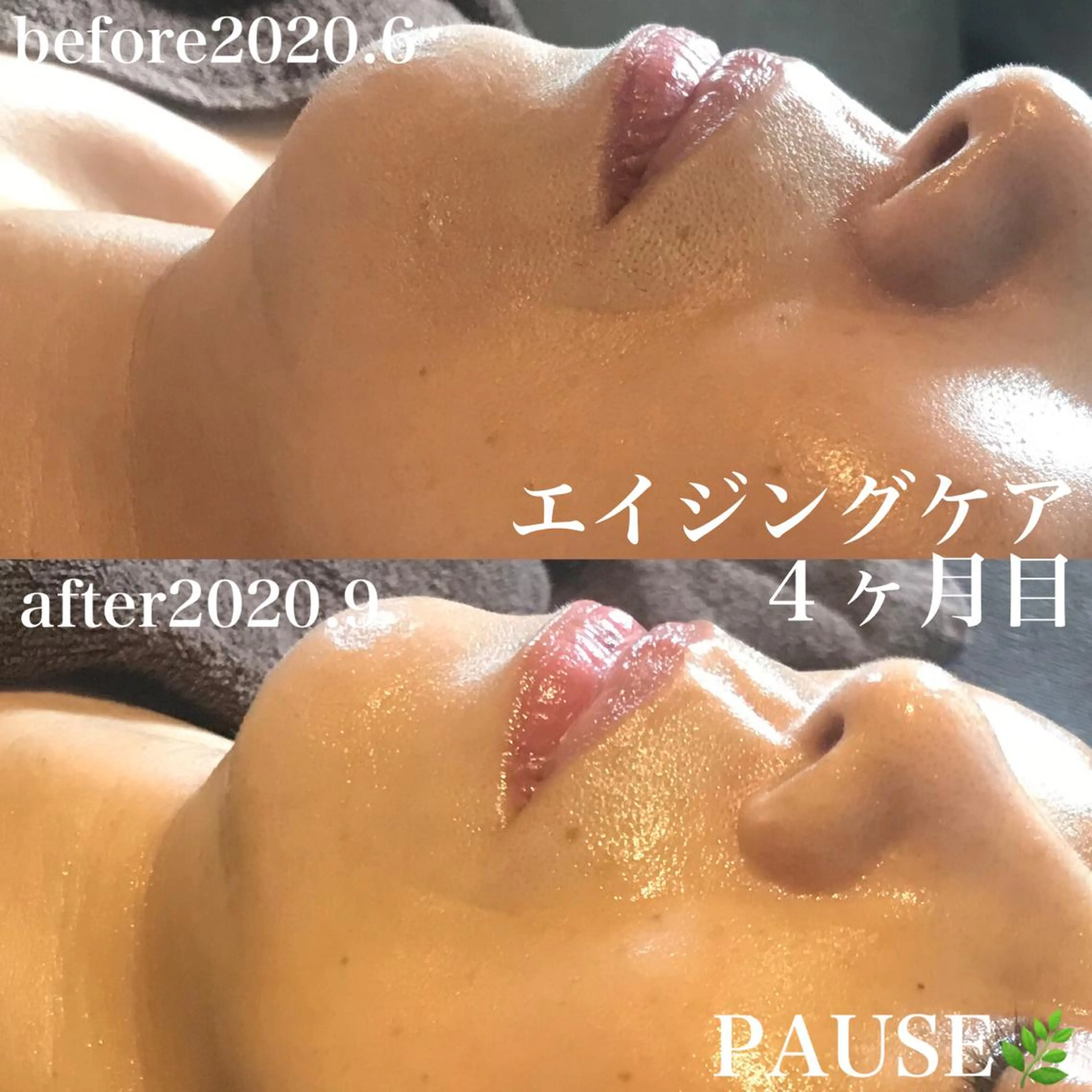 エステ 浜野 恵美のエステ・リラクイメージ