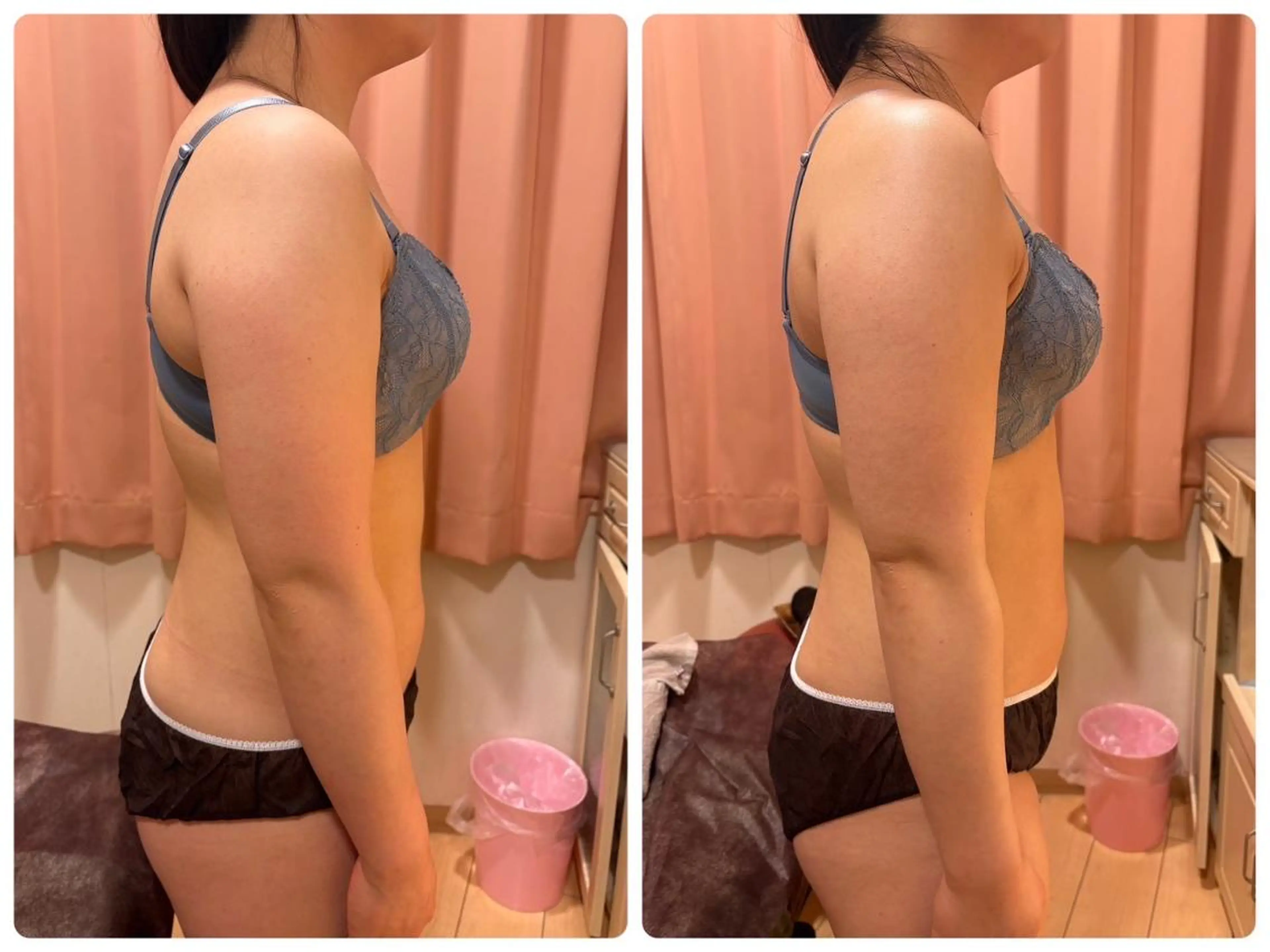 バスト＆フェイシャル RAYVIS💗木島のエステ・リラクイメージ