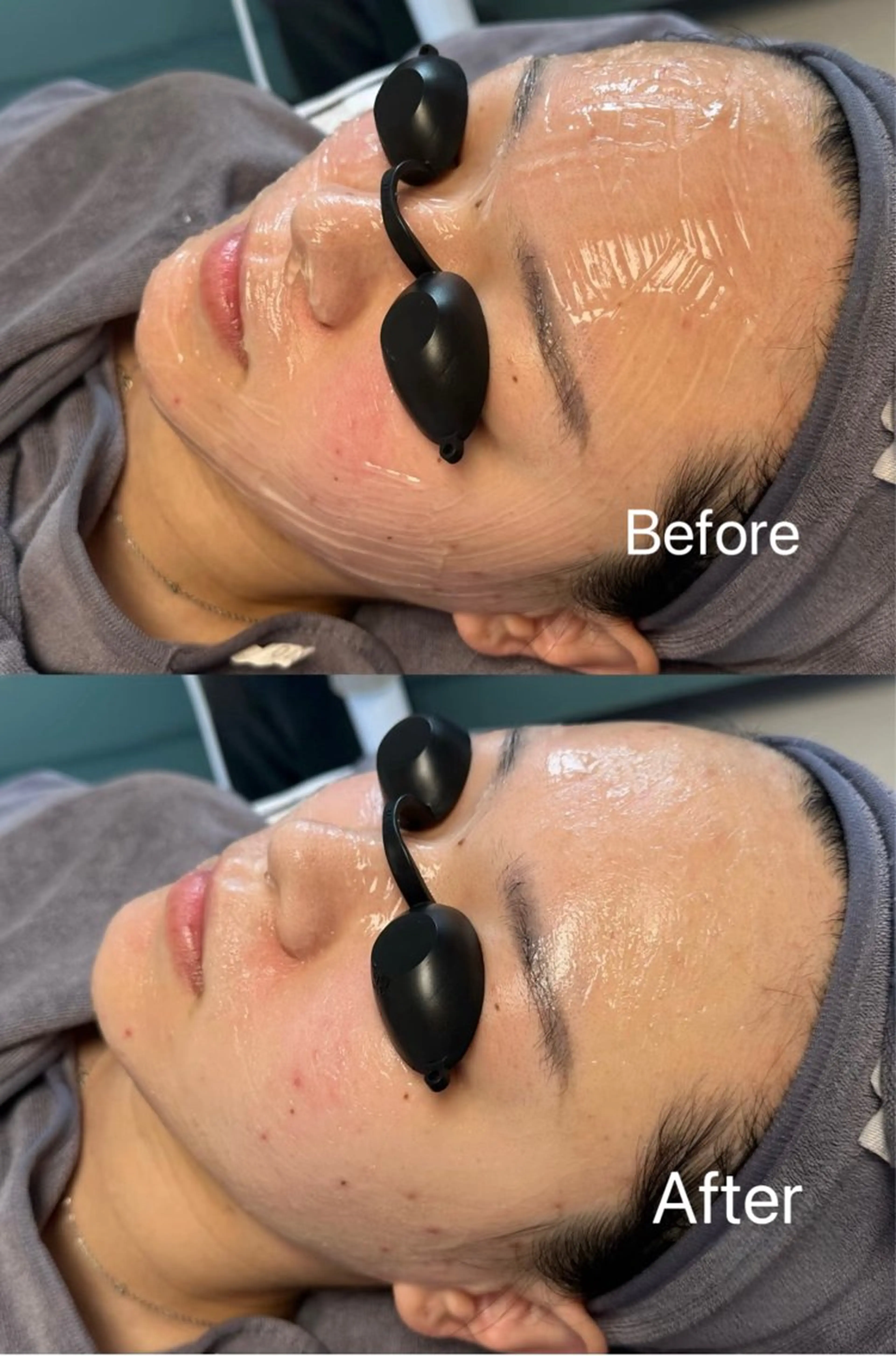 THEONE 山本のエステ・リラクイメージ