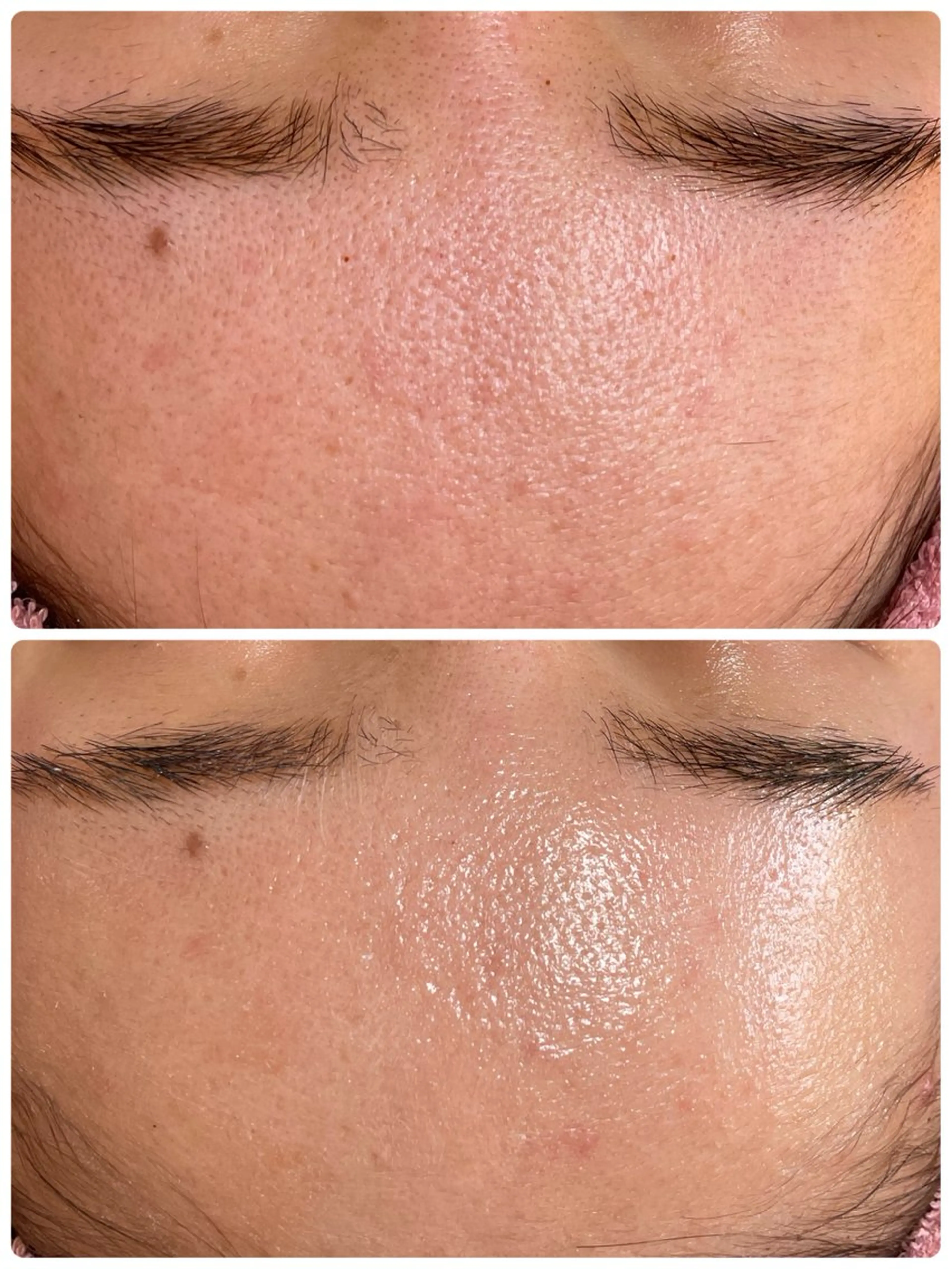 エステ 心満たされる ハーブピーリング絹々のエステ・リラクイメージ