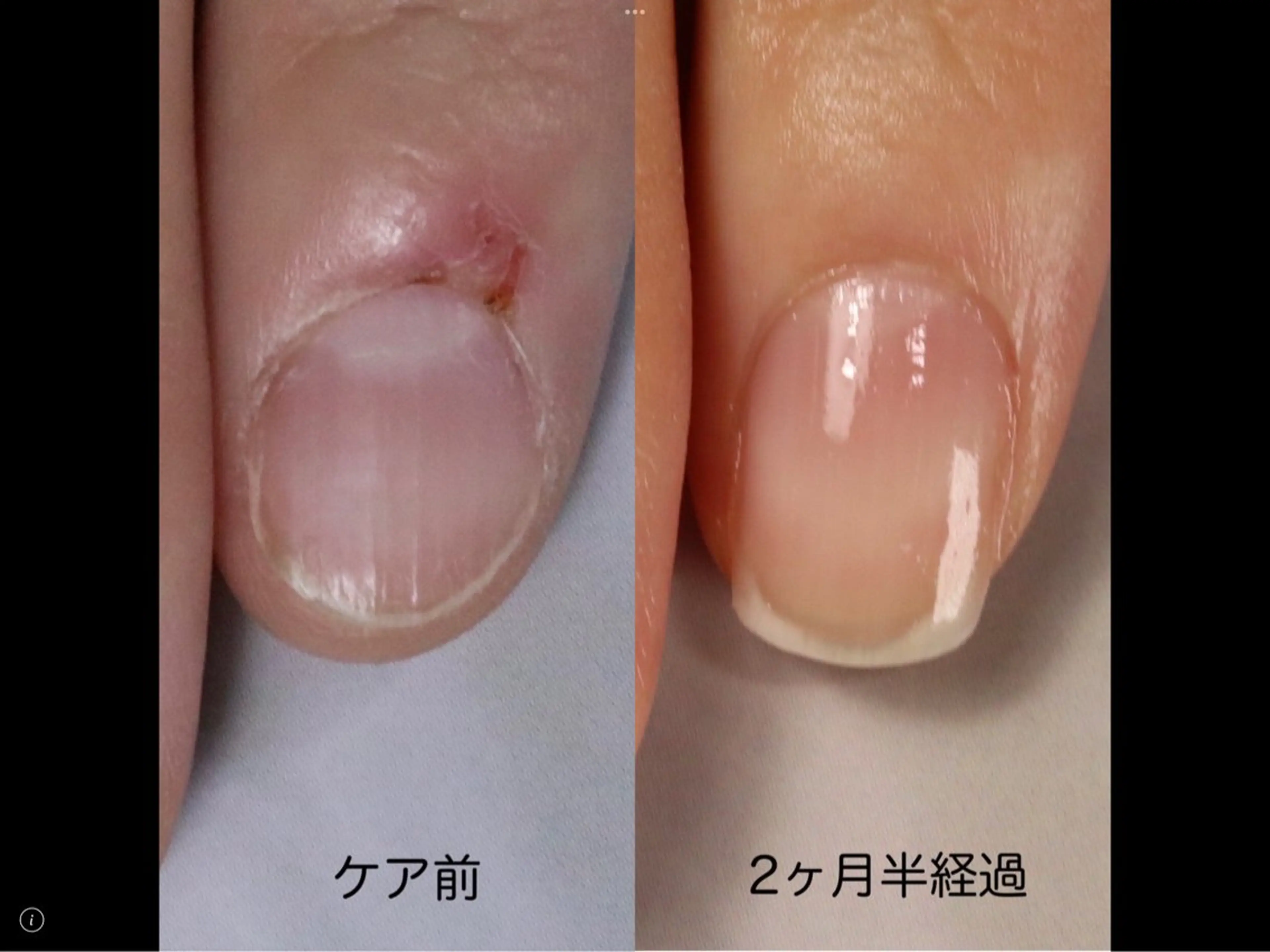 ネイル プライベートサロン jewel nailのネイルデザイン