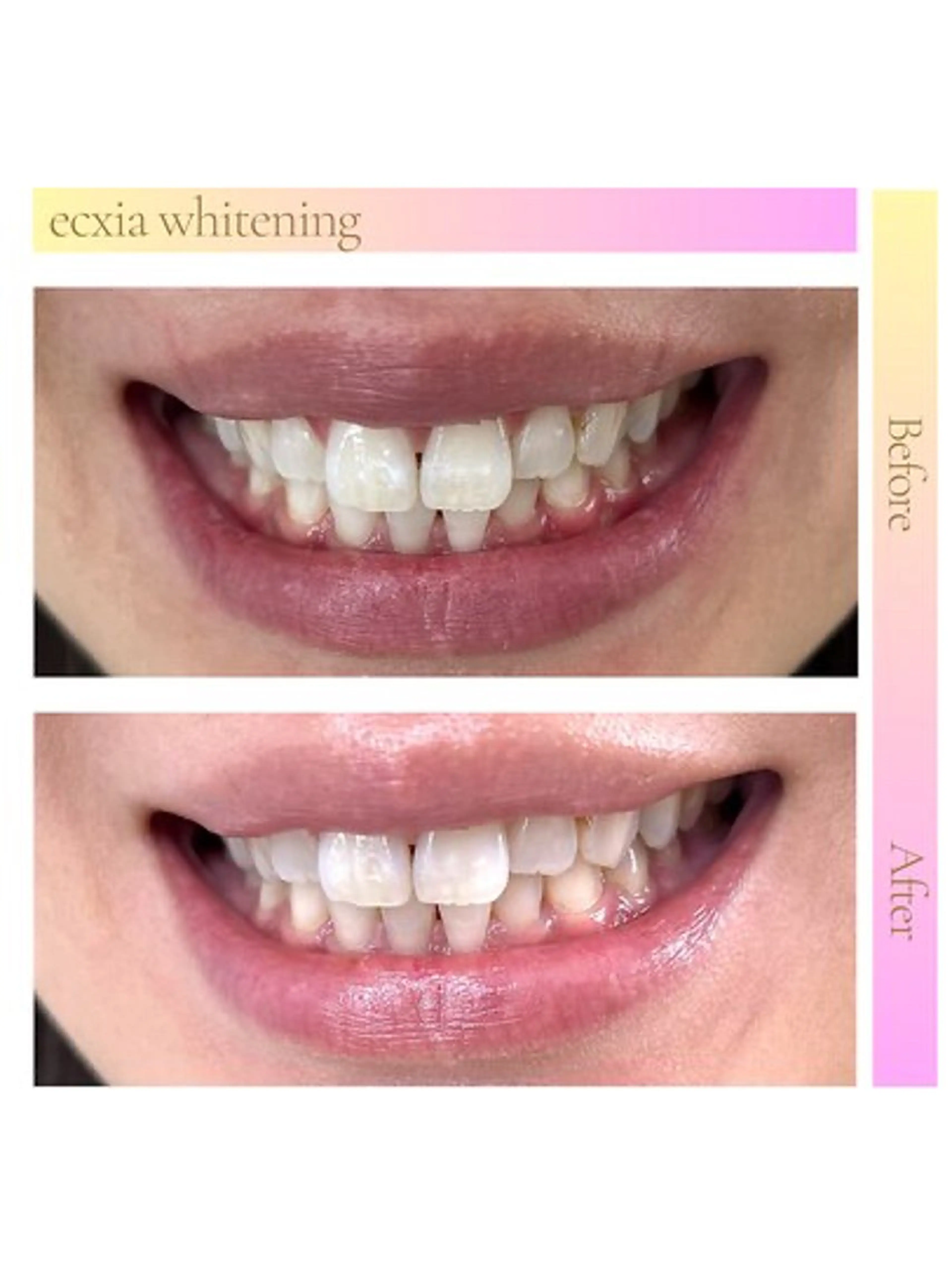 エクシア ホワイトニング西条店のその他イメージ