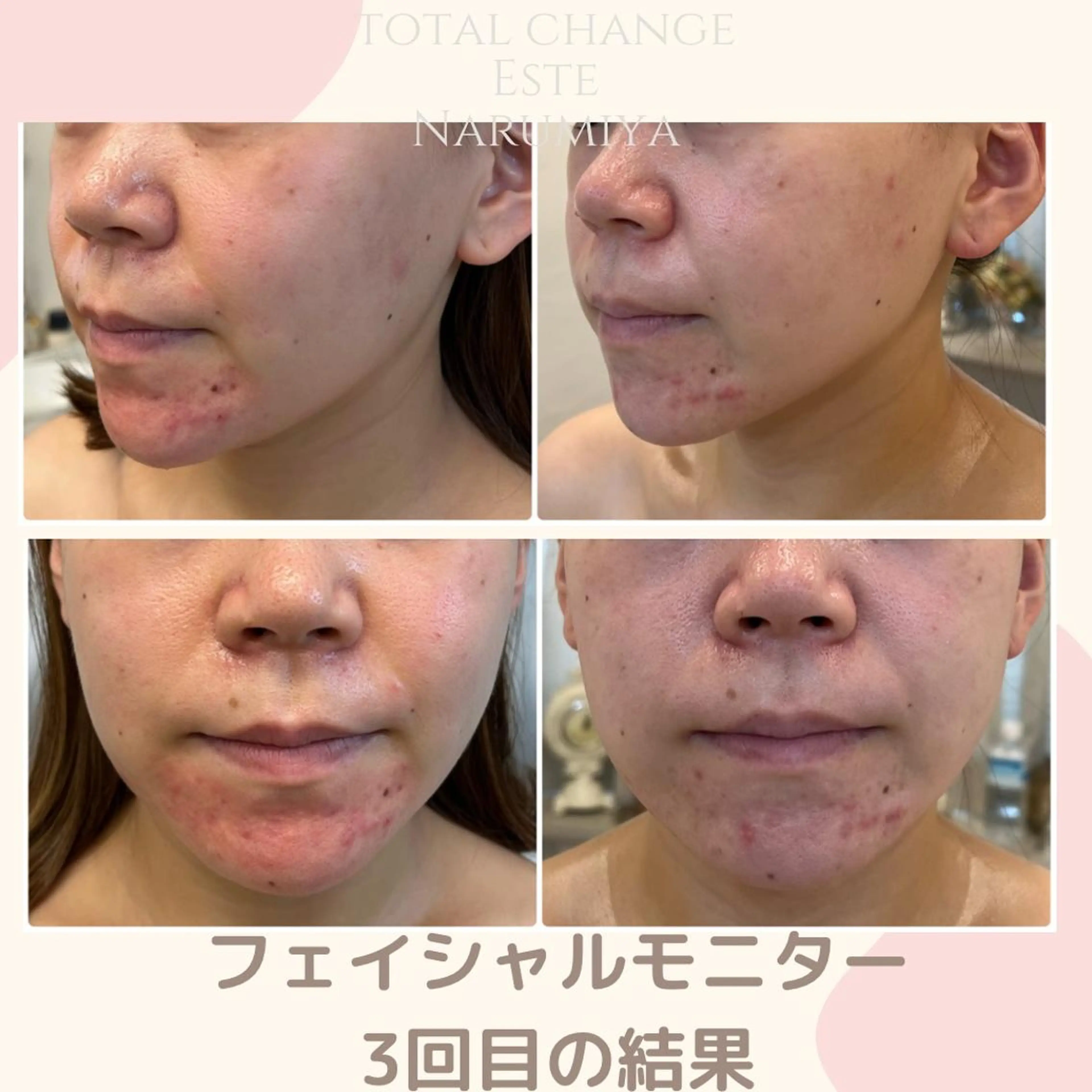 エステ 辻 佐耶のエステ・リラクイメージ