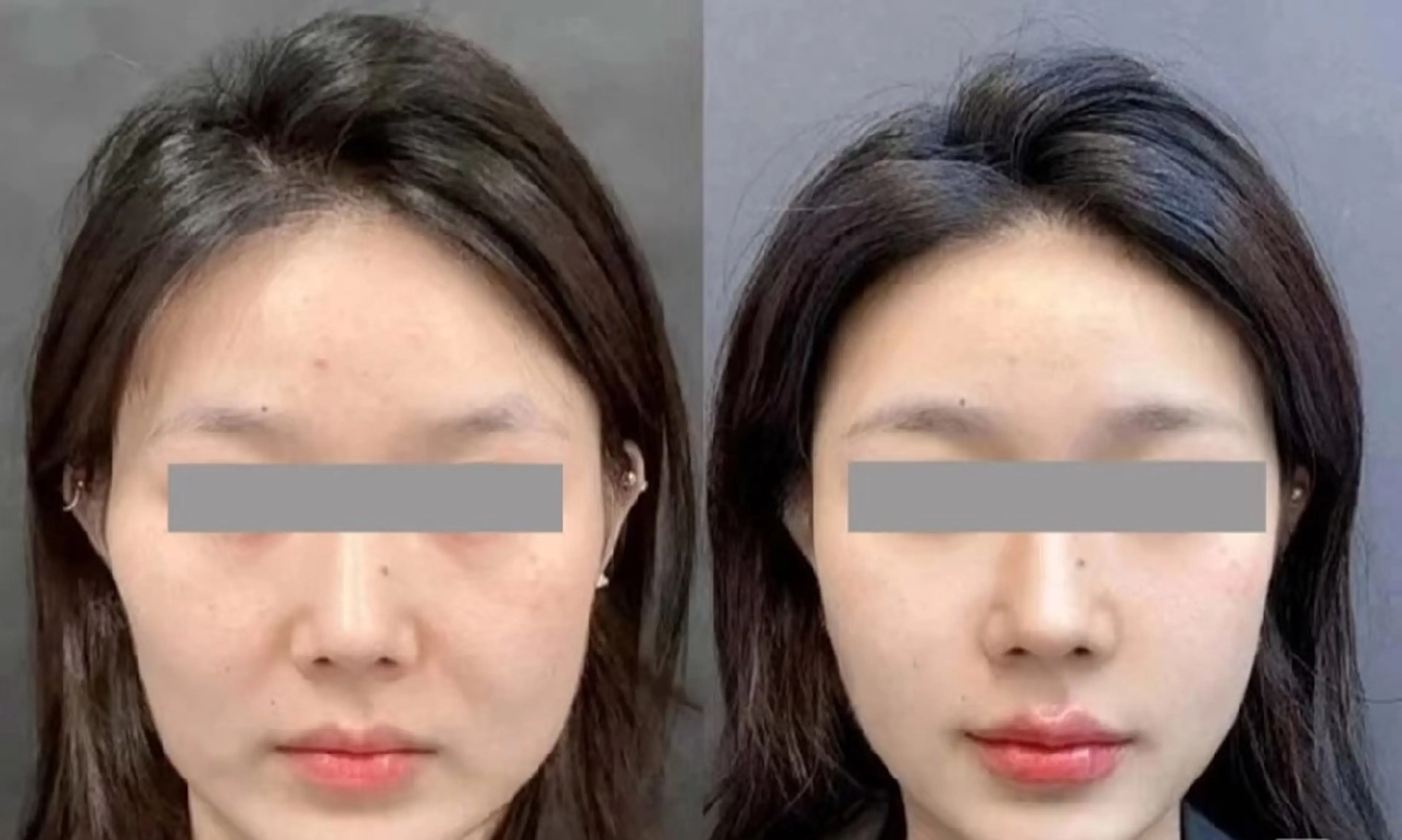 アイブロウ 眉毛ワックス脱毛 aliaハーブ水光店 エステティシャン募集のエステ・リラクイメージ