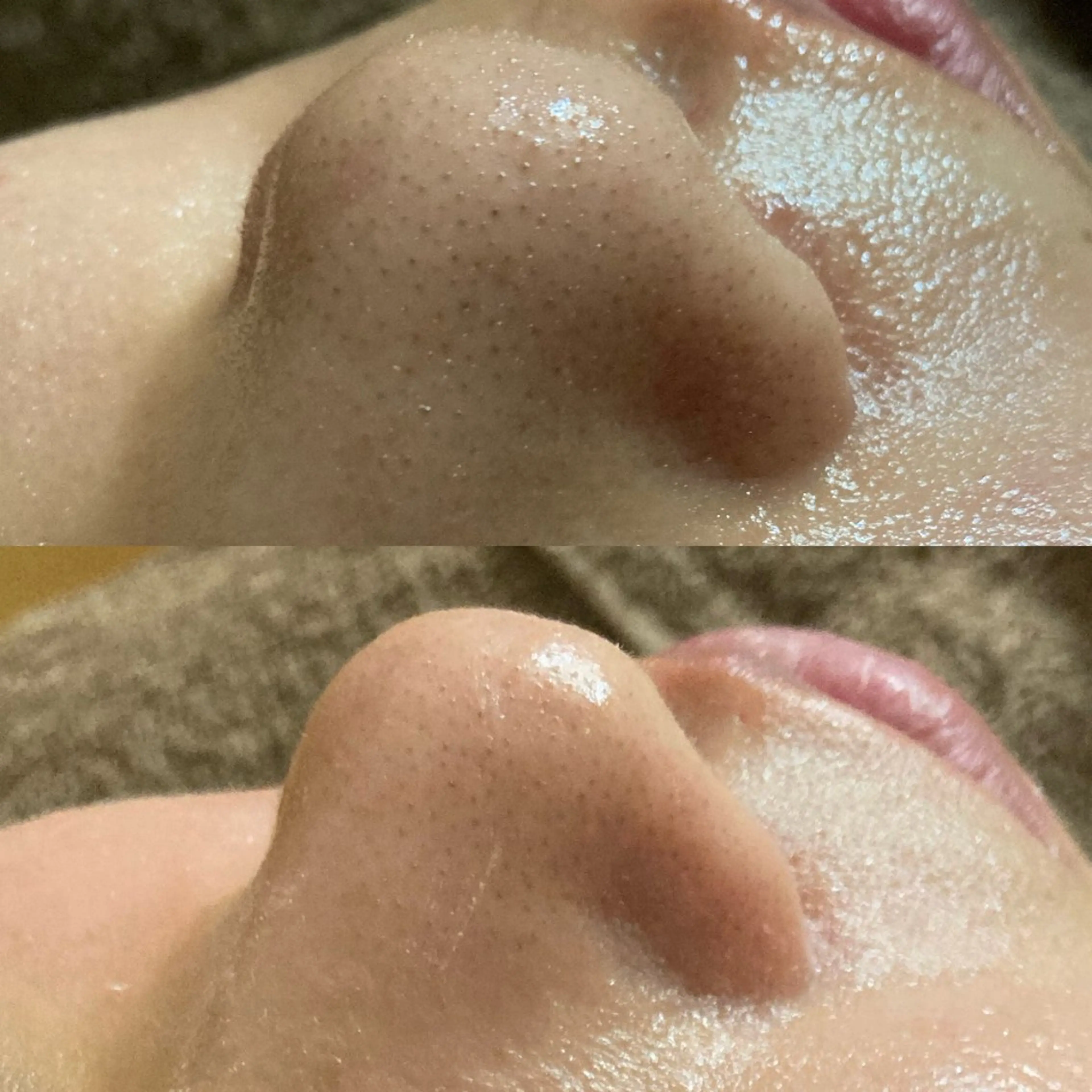 磐田｜LAYLA 一番丁寧な脱毛店のエステ・リラクイメージ