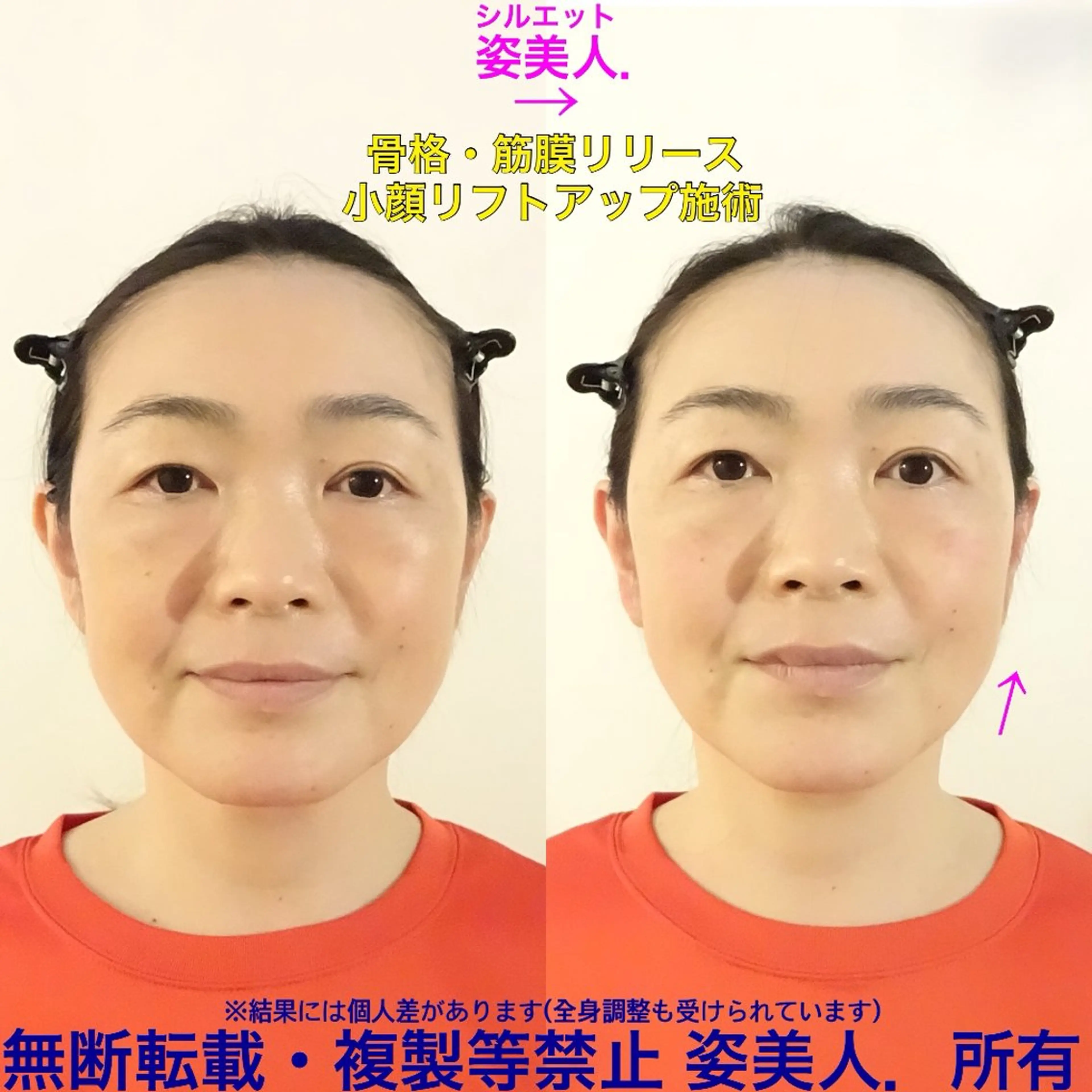 筋膜整体＆小顔矯正 　姿美人.シルエットのエステ・リラクイメージ