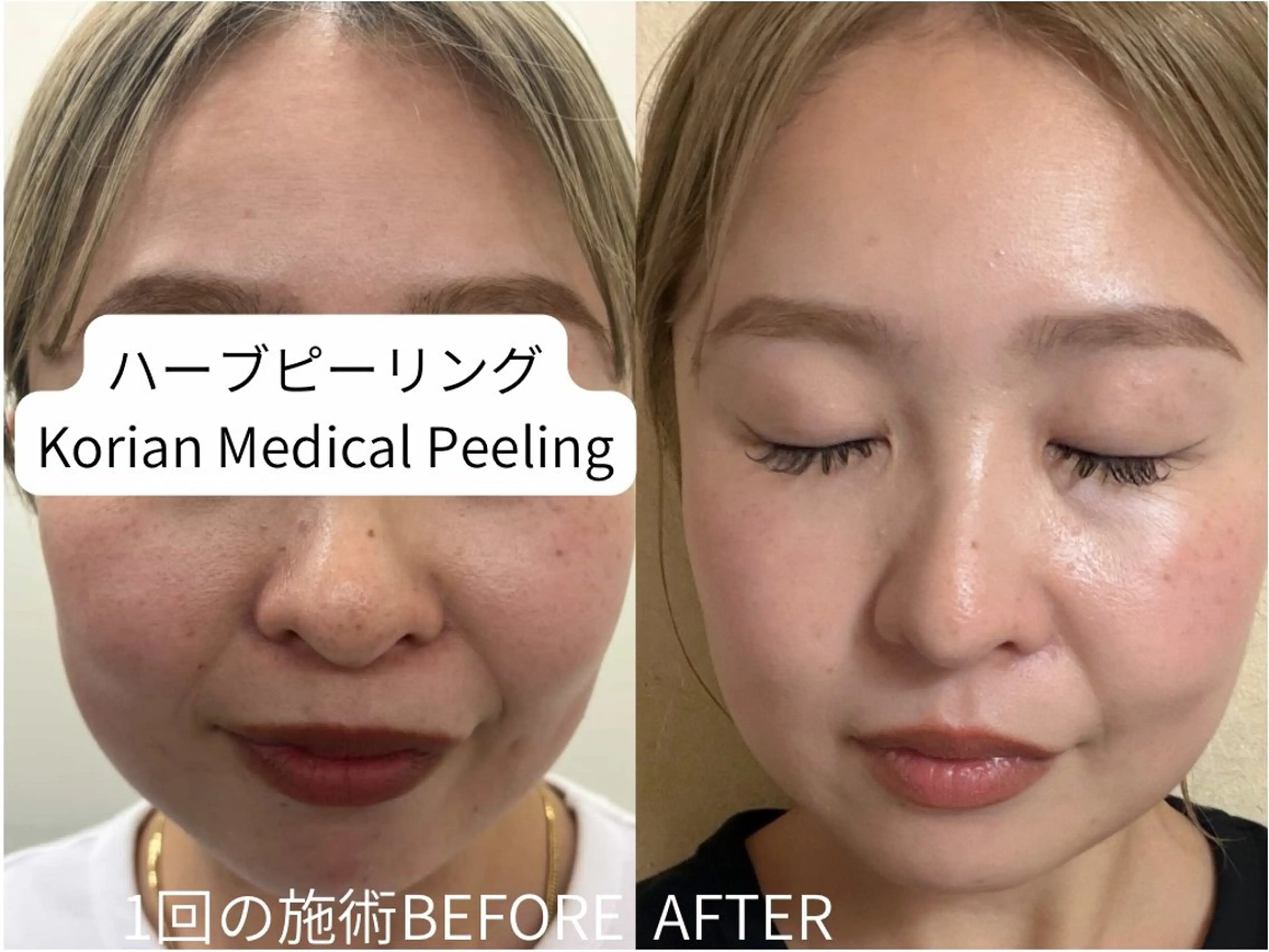 LUVRE龍田 MIKIまつ毛/眉毛の眉毛・アイブロウイメージ