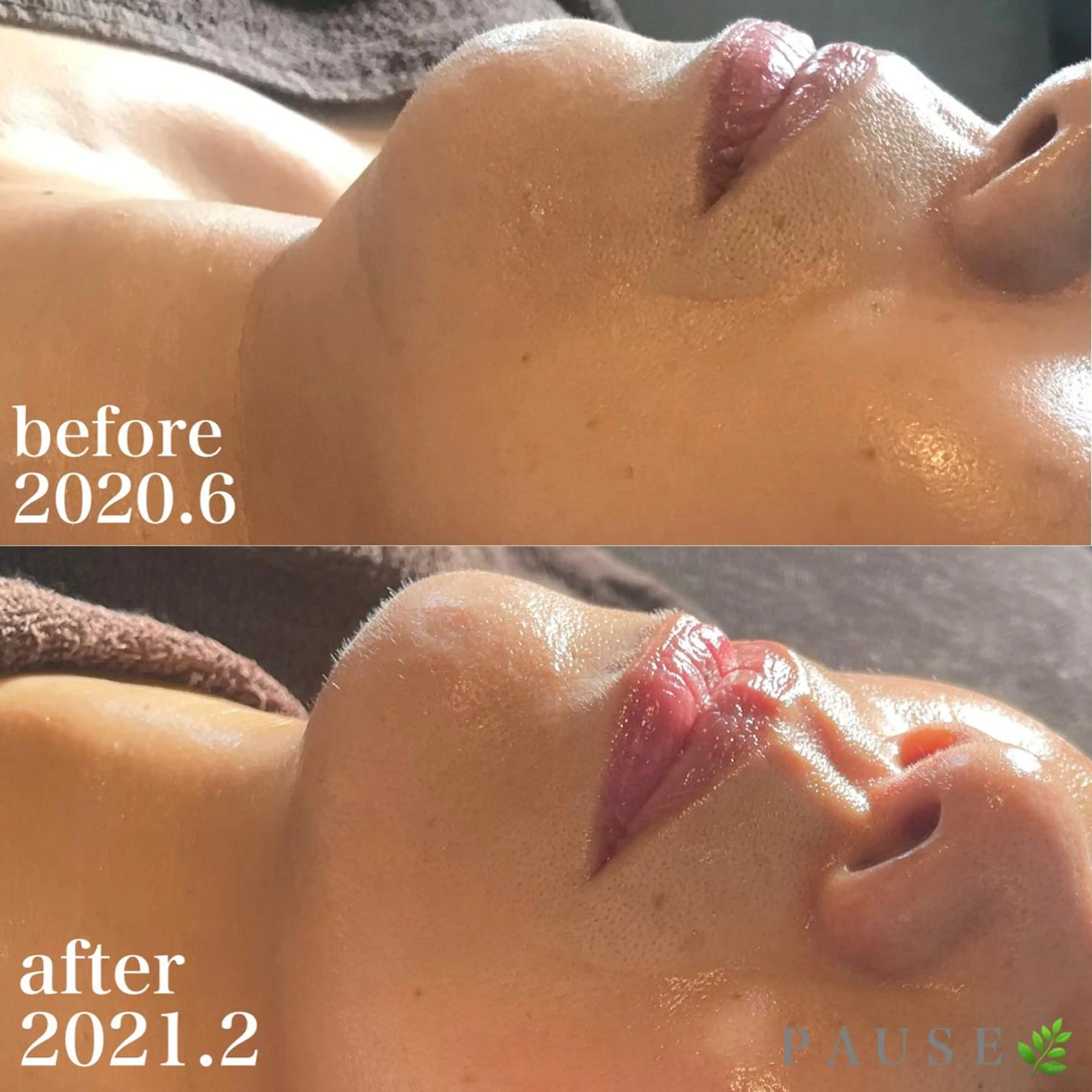 エステ 浜野 恵美のエステ・リラクイメージ