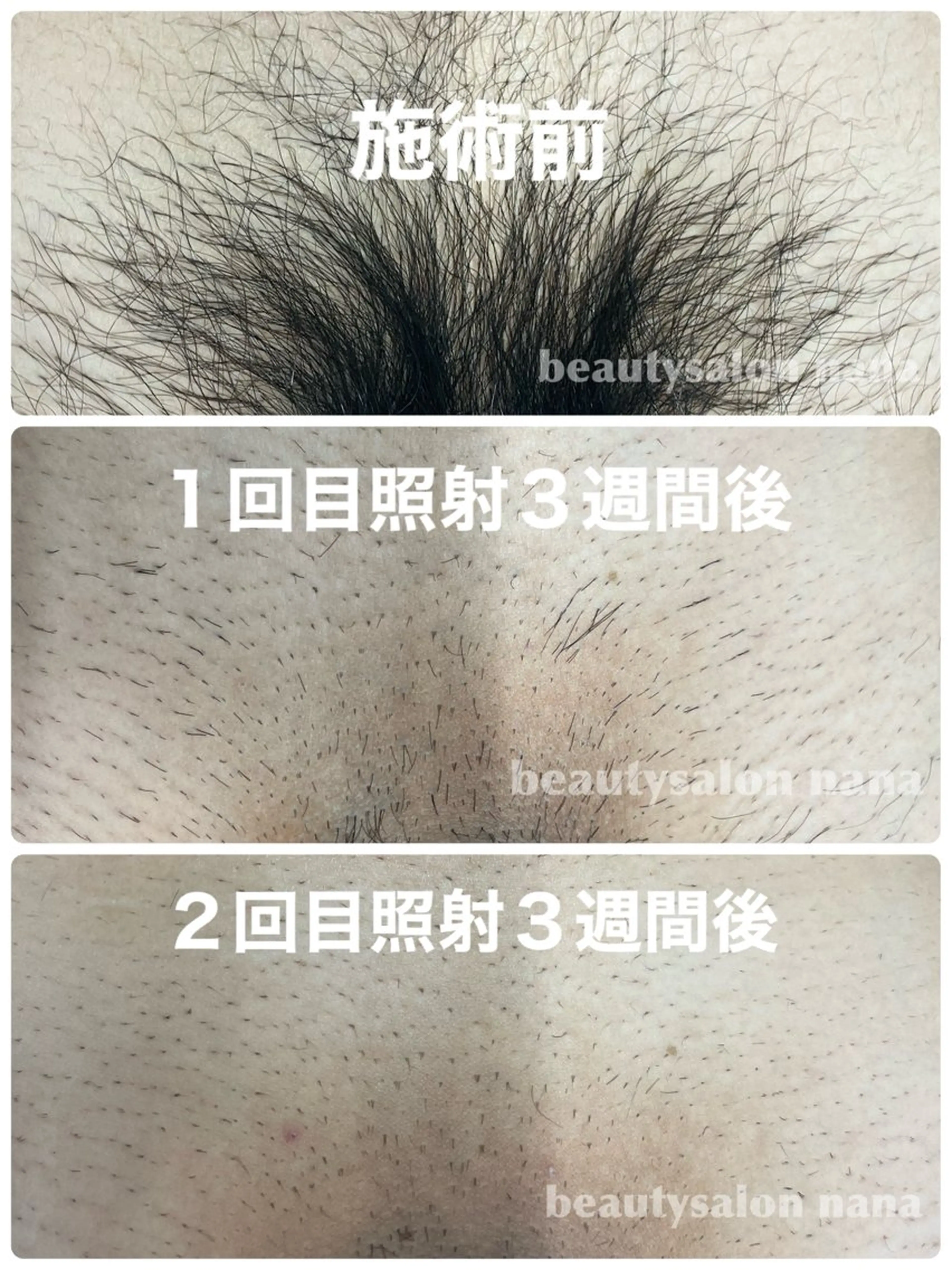 beauty salon　nanaのエステ・リラクイメージ