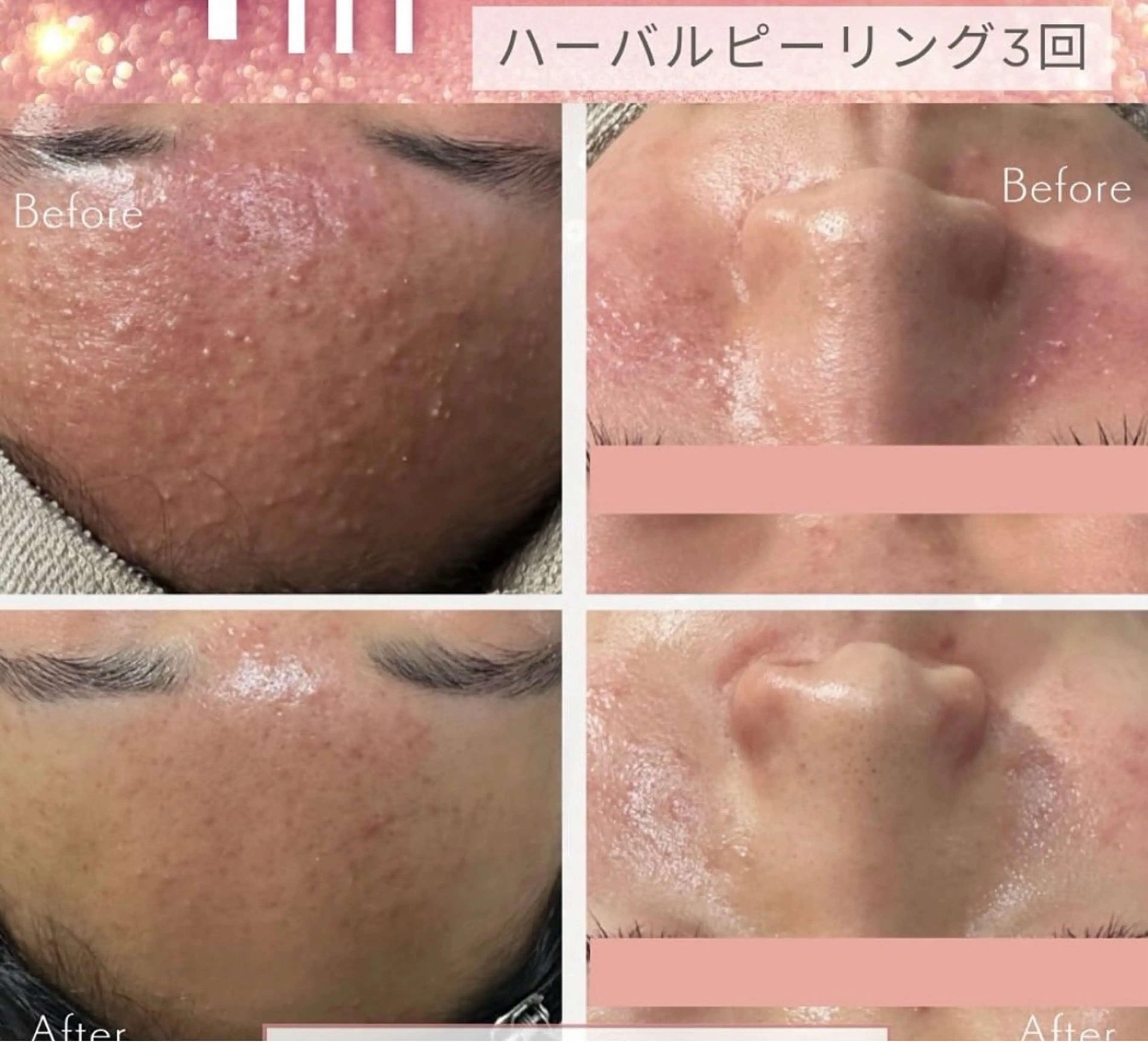 アロマ&アーユルヴェーダサロンParadiso横浜所属・冨菜 みらいのエステ・リラクイメージ