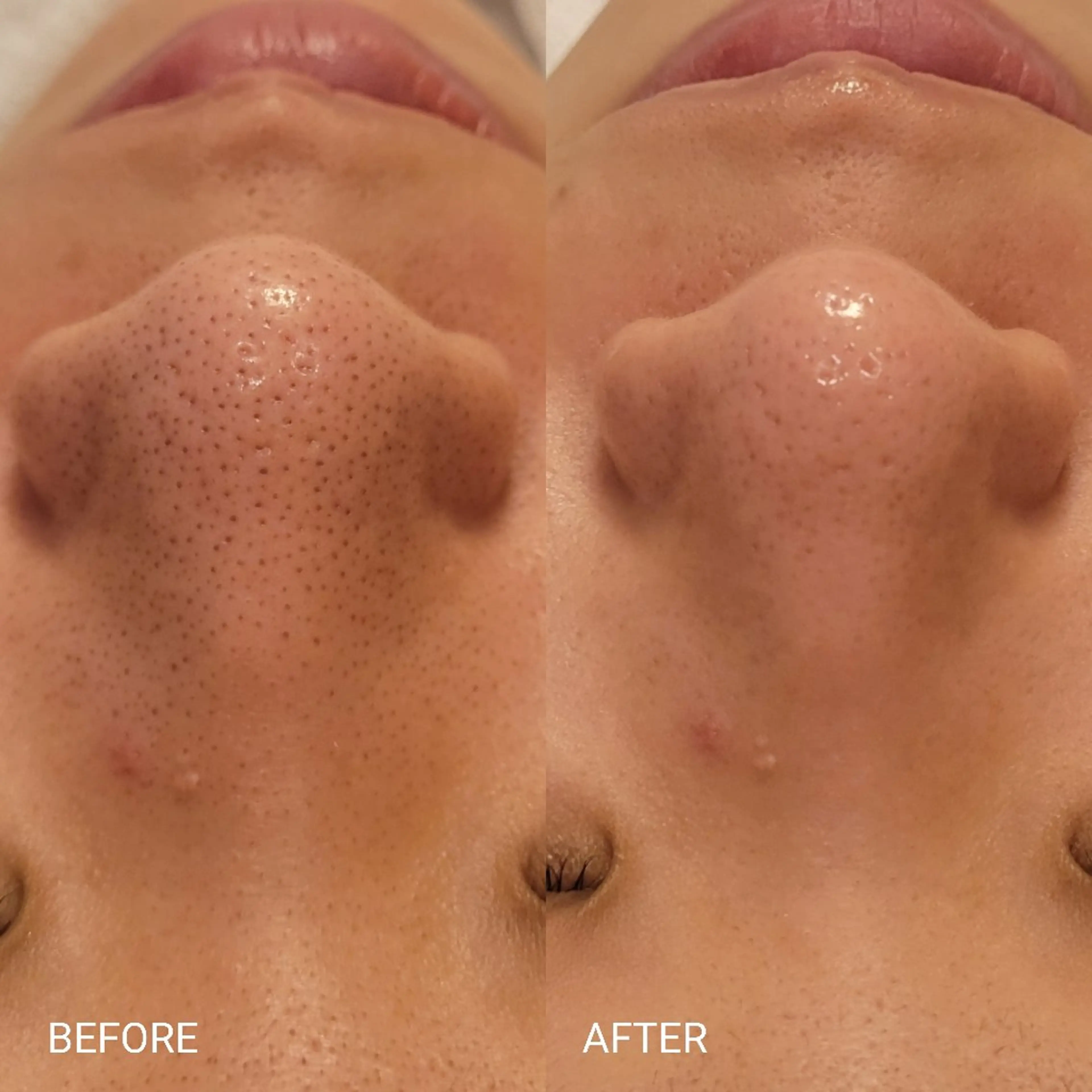 エステ 毛穴/肌管理/痩身/ ボディケア/satoのエステ・リラクイメージ