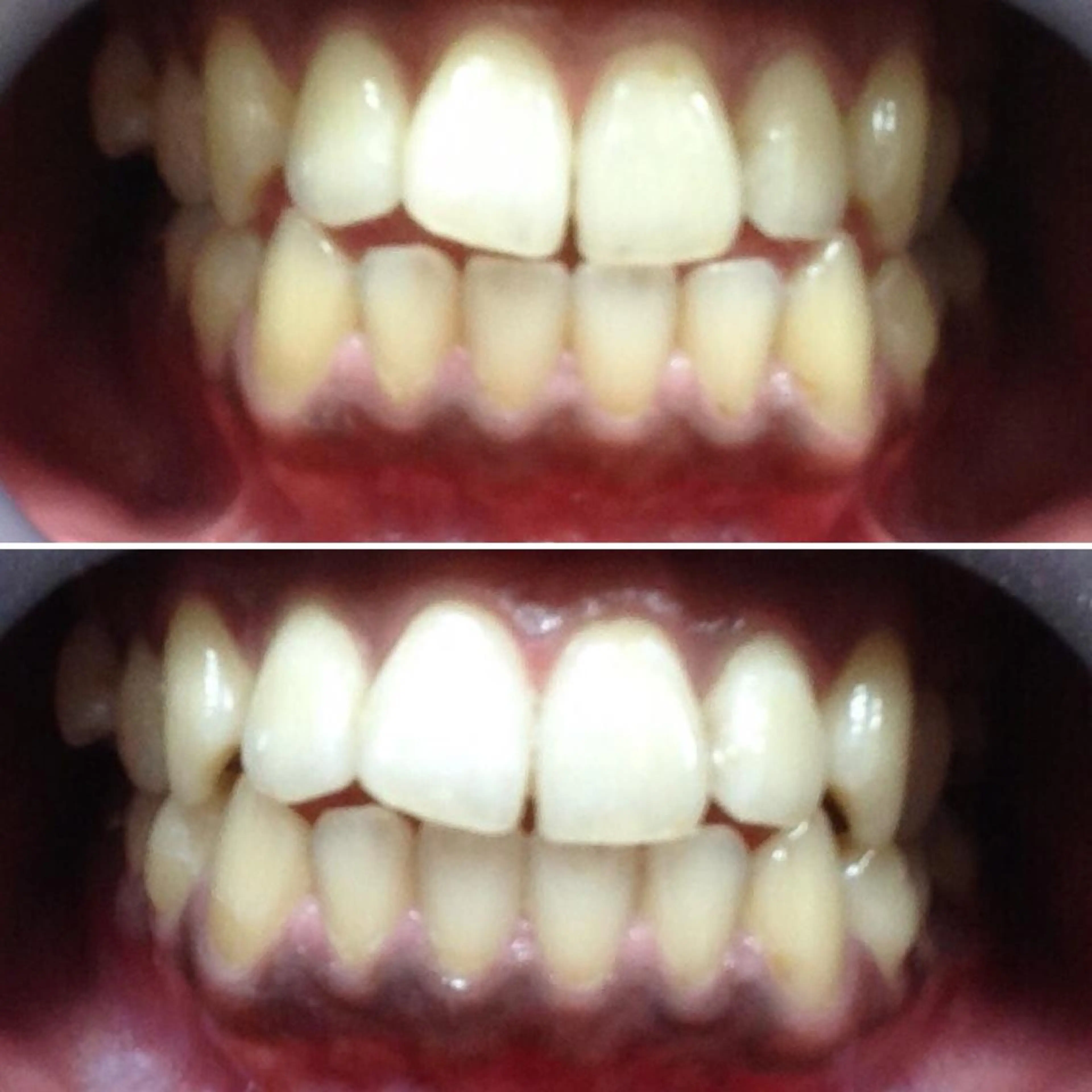 ホワイトニングスクエ ア by アバンティのその他イメージ