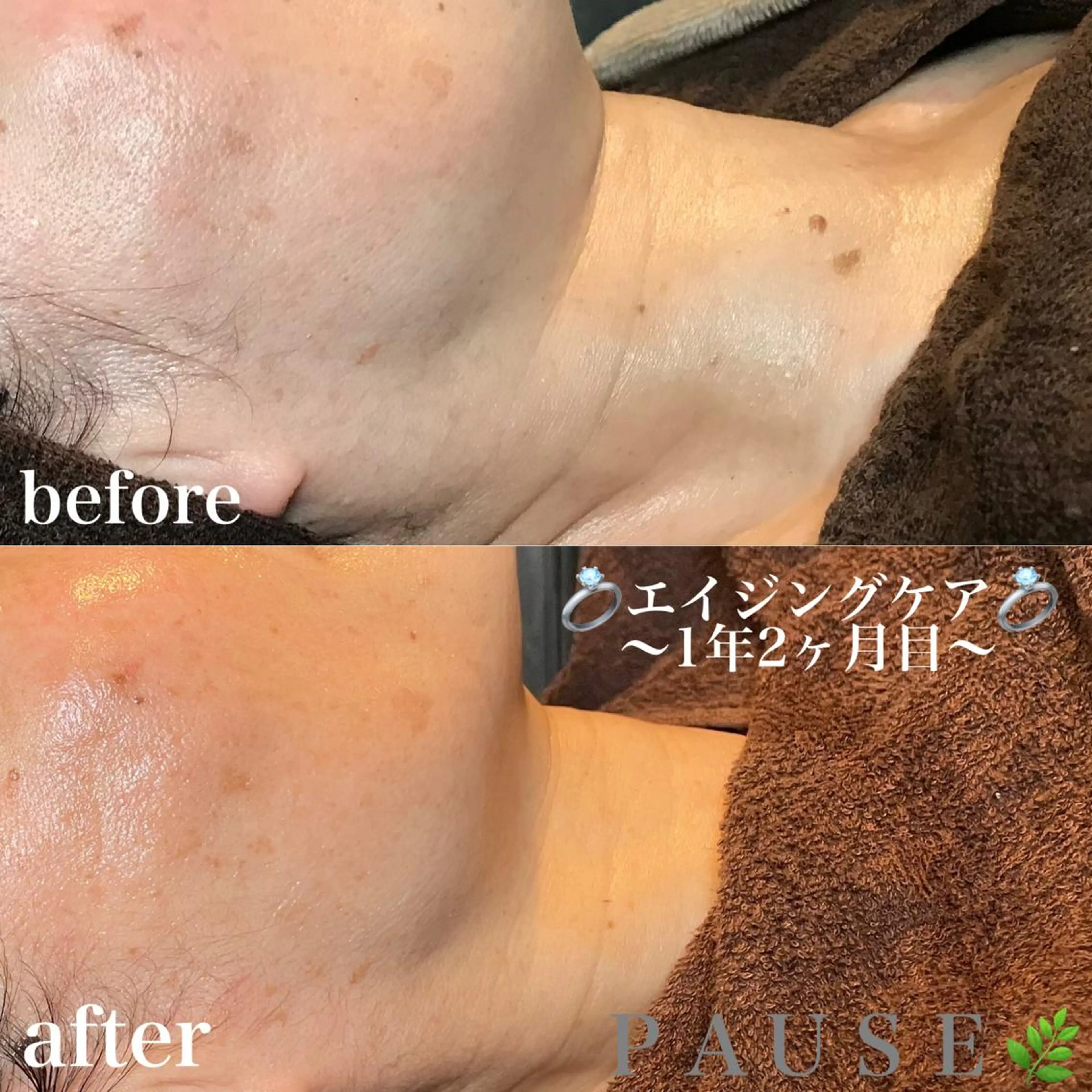 エステ 浜野 恵美のエステ・リラクイメージ