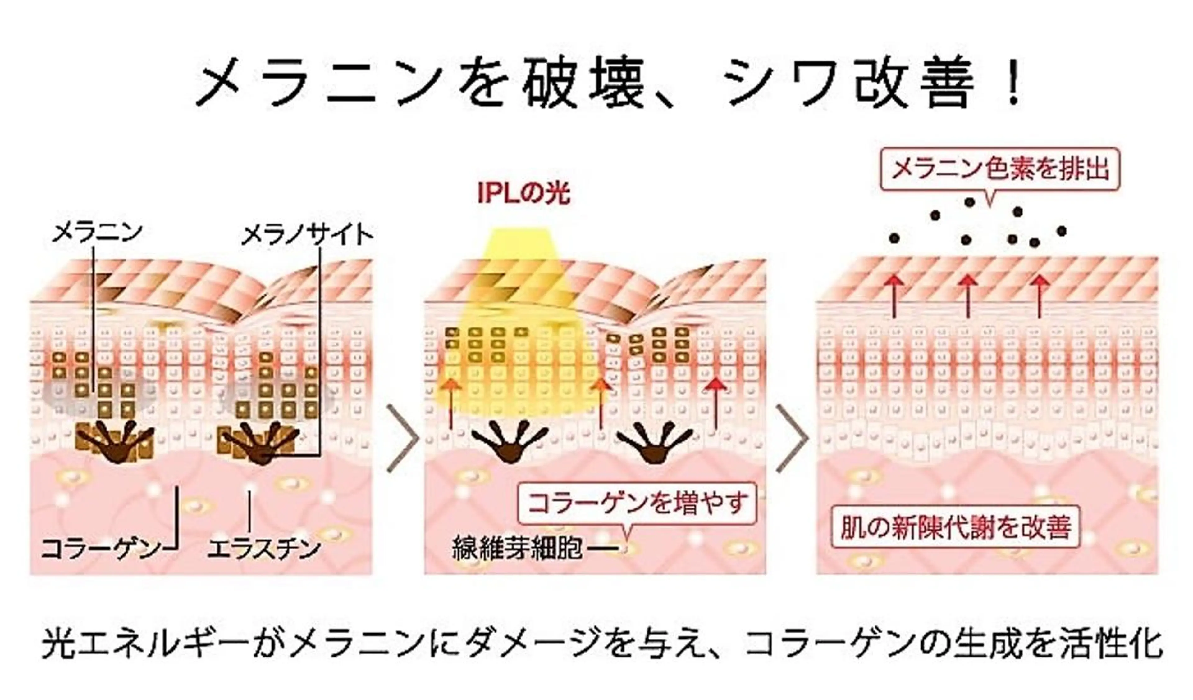 脱毛 aliaハーブ水光店 エステティシャン募集のエステ・リラクイメージ