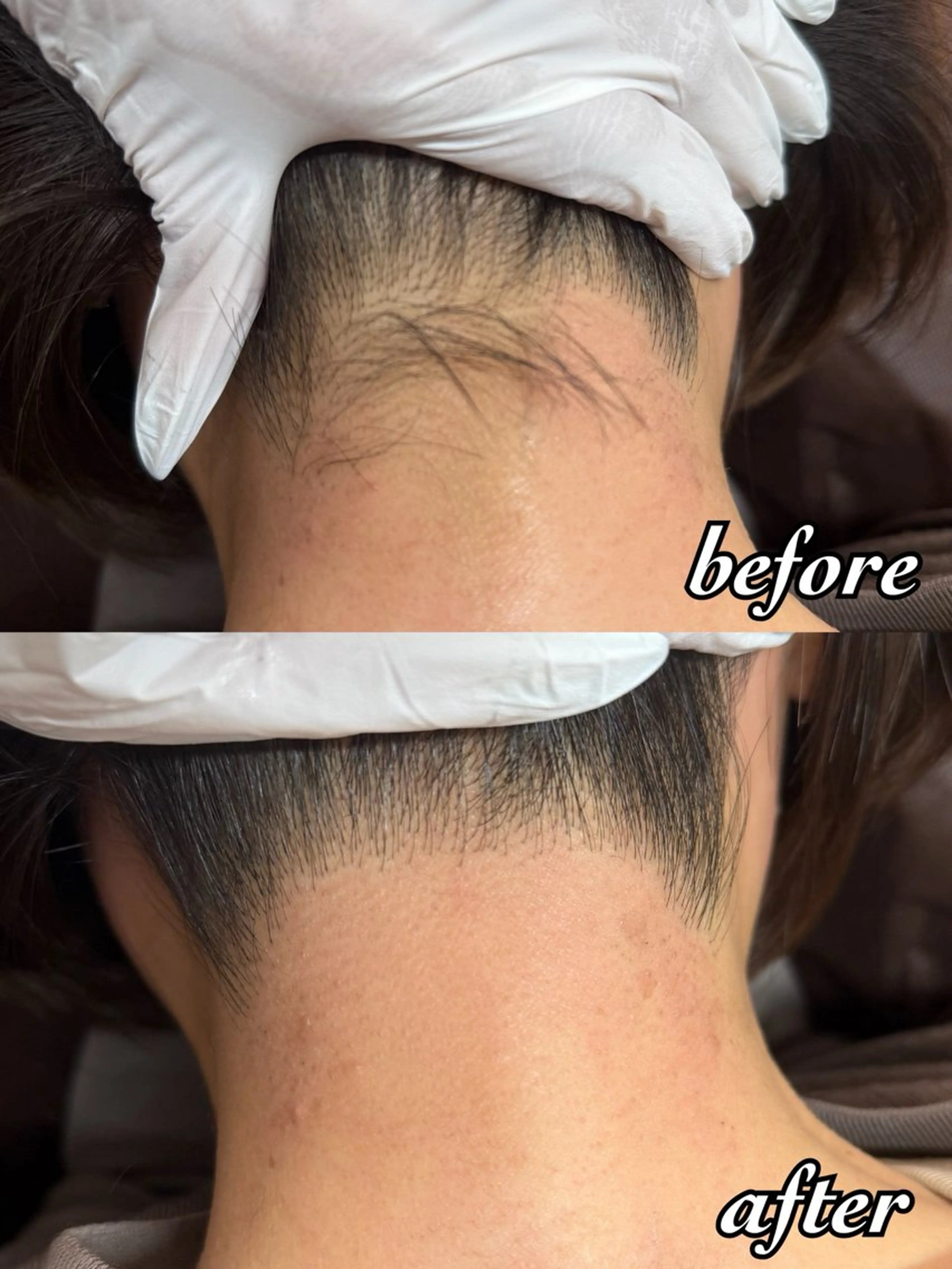 脱毛サロン CREVIOのエステ・リラクイメージ