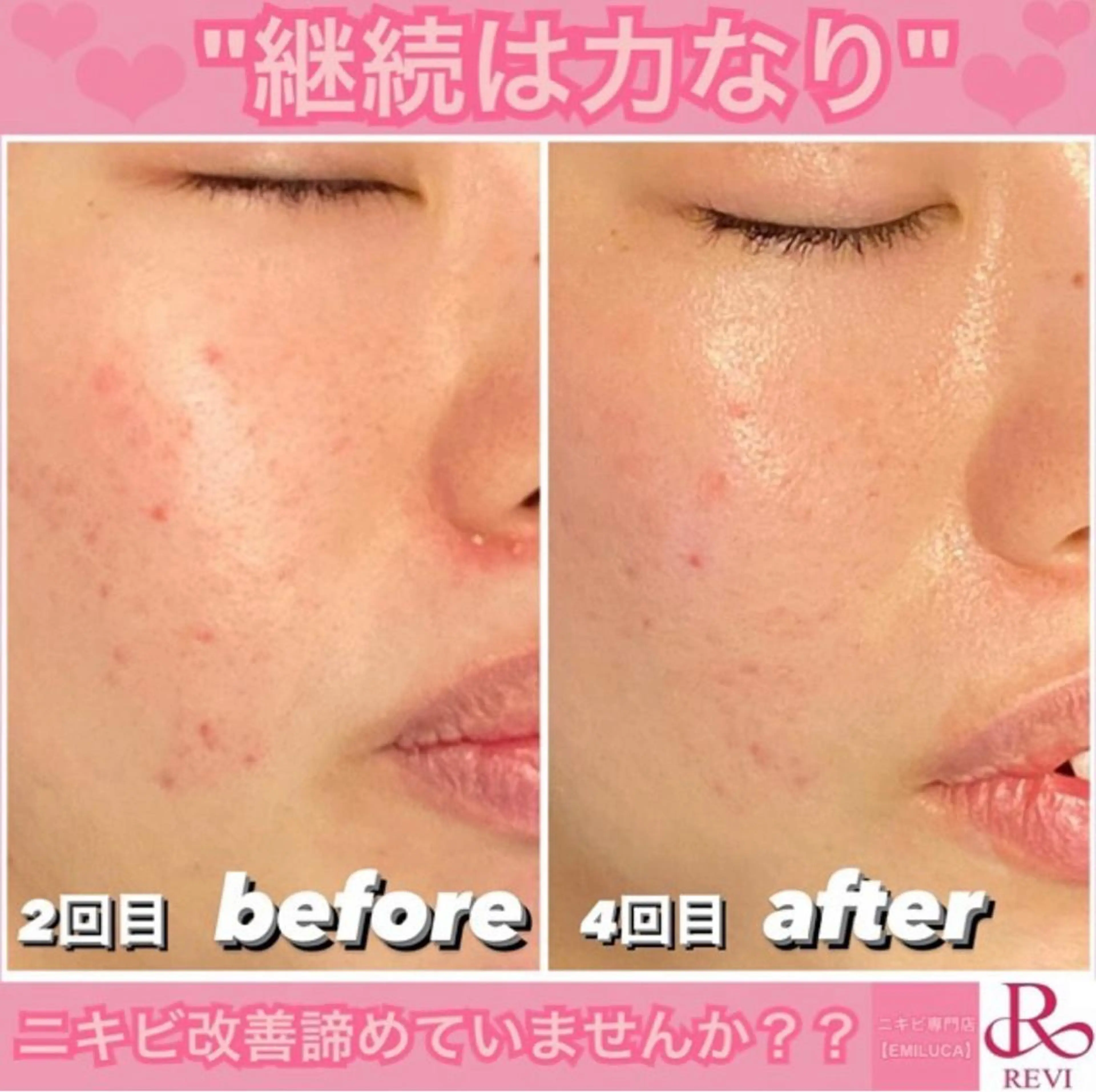 EMILU CAのエステ・リラクイメージ