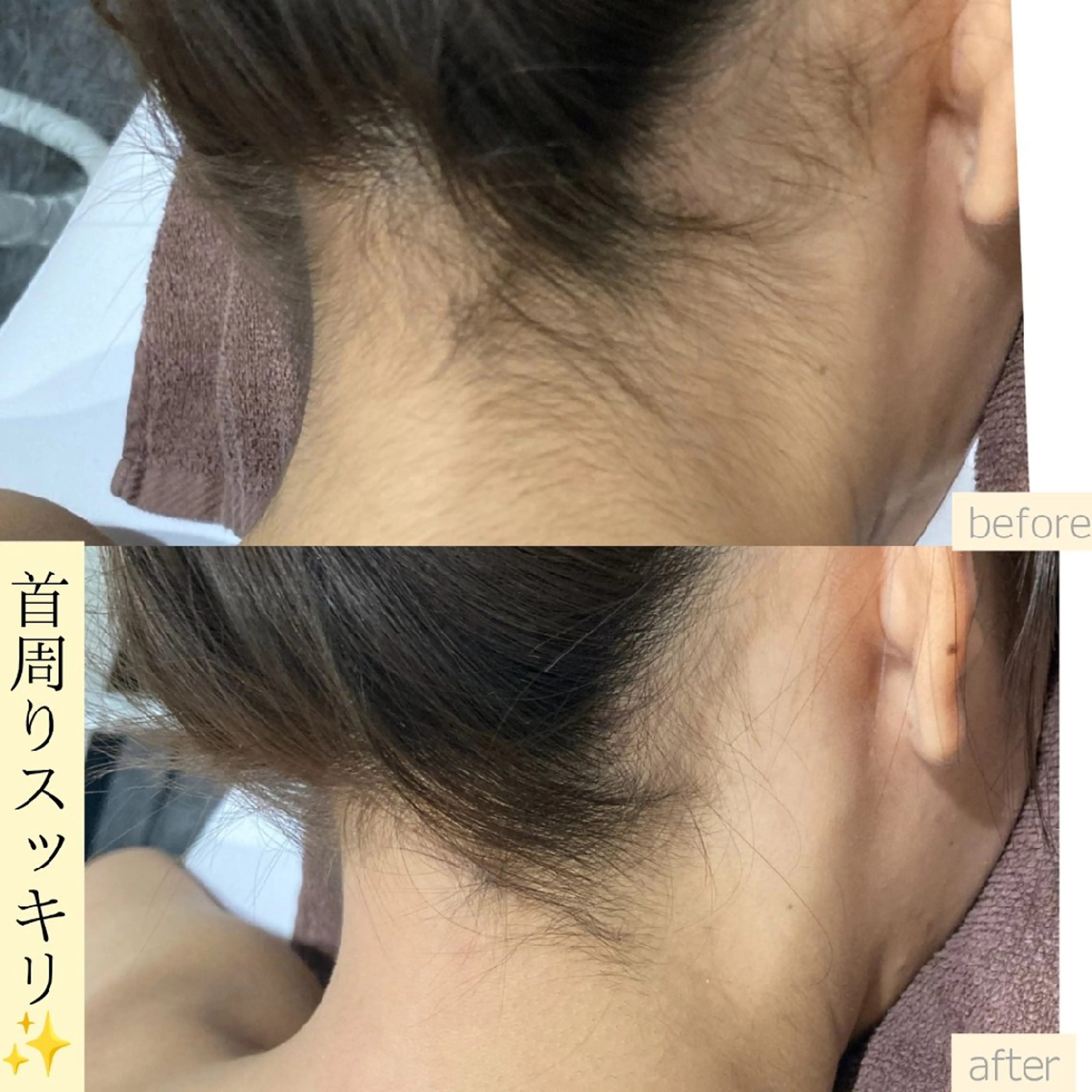 脱毛 Dahlia痩身脱毛 フェイシャル 中村のエステ・リラクイメージ