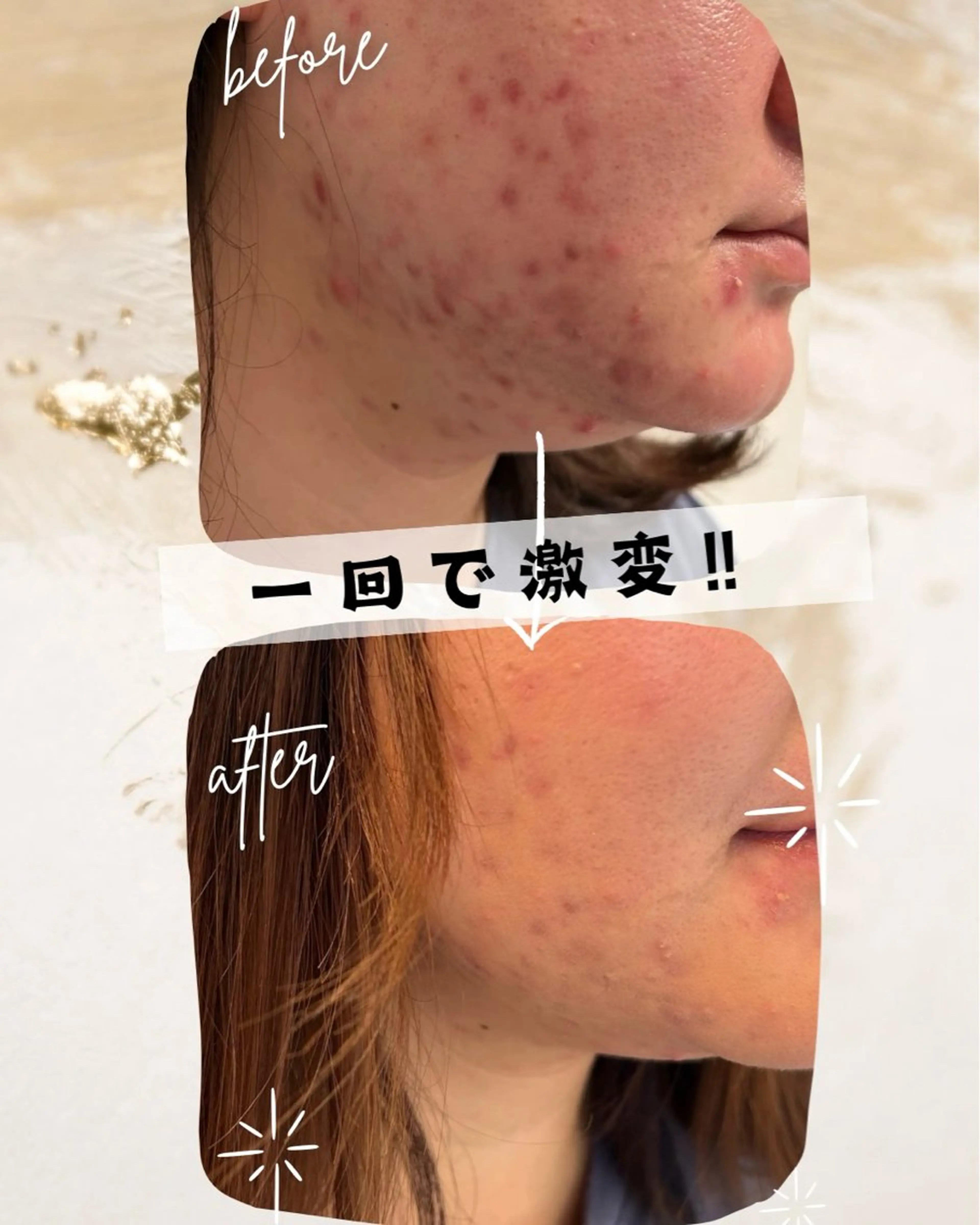 エステ 小滝 悠妃のネイルデザイン