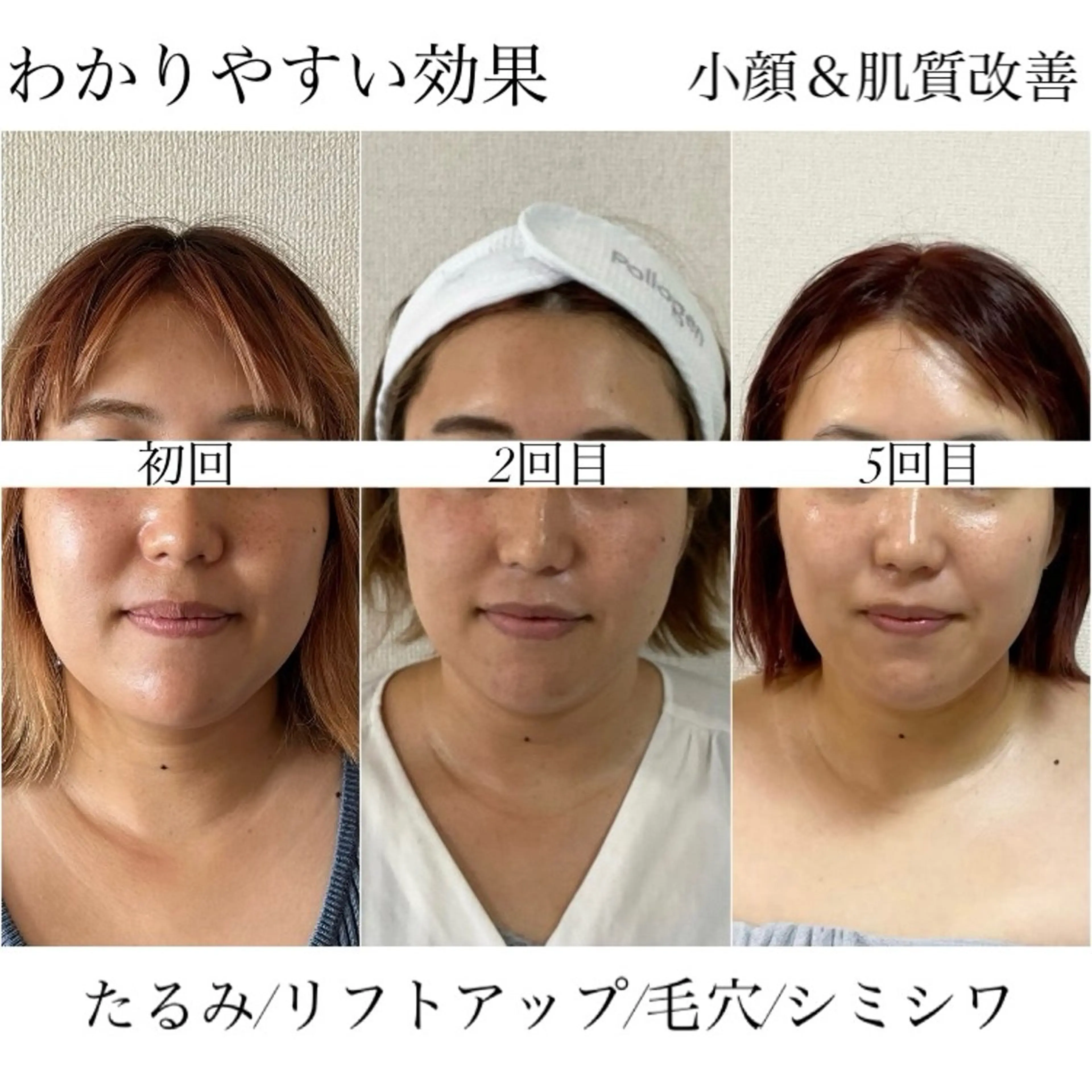 小顔×肌質改善 《お顔の印象》のエステ・リラクイメージ