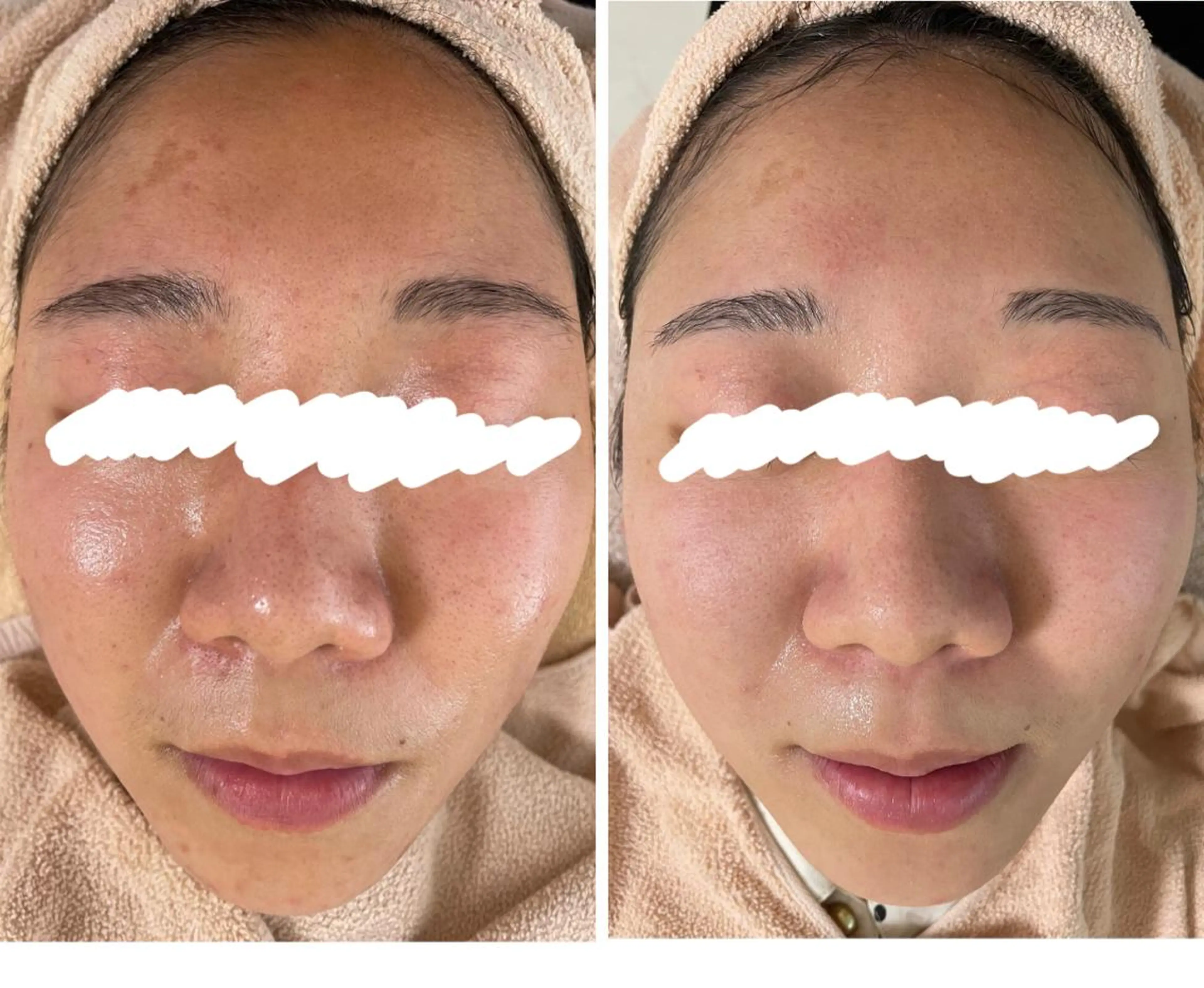 ロング カラー パーマ ヘアアレンジ メンズ キッズ ネイル マツエク・マツパ アイブロウ エステ ニキビ&跡改善サロン オーナー光木のエステ・リラクイメージ