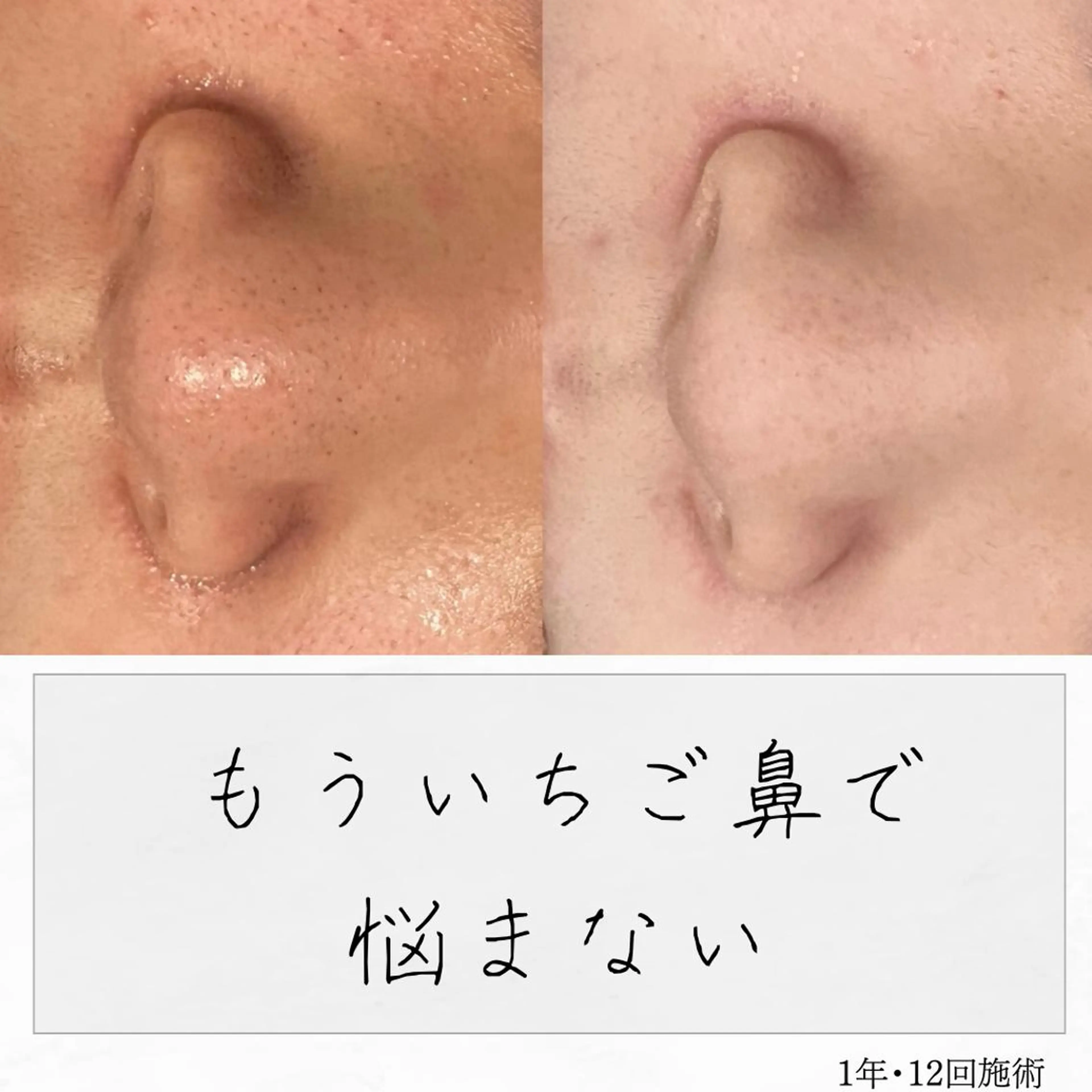 ニキビ経験者が施術 する専門サロン🌻のエステ・リラクイメージ