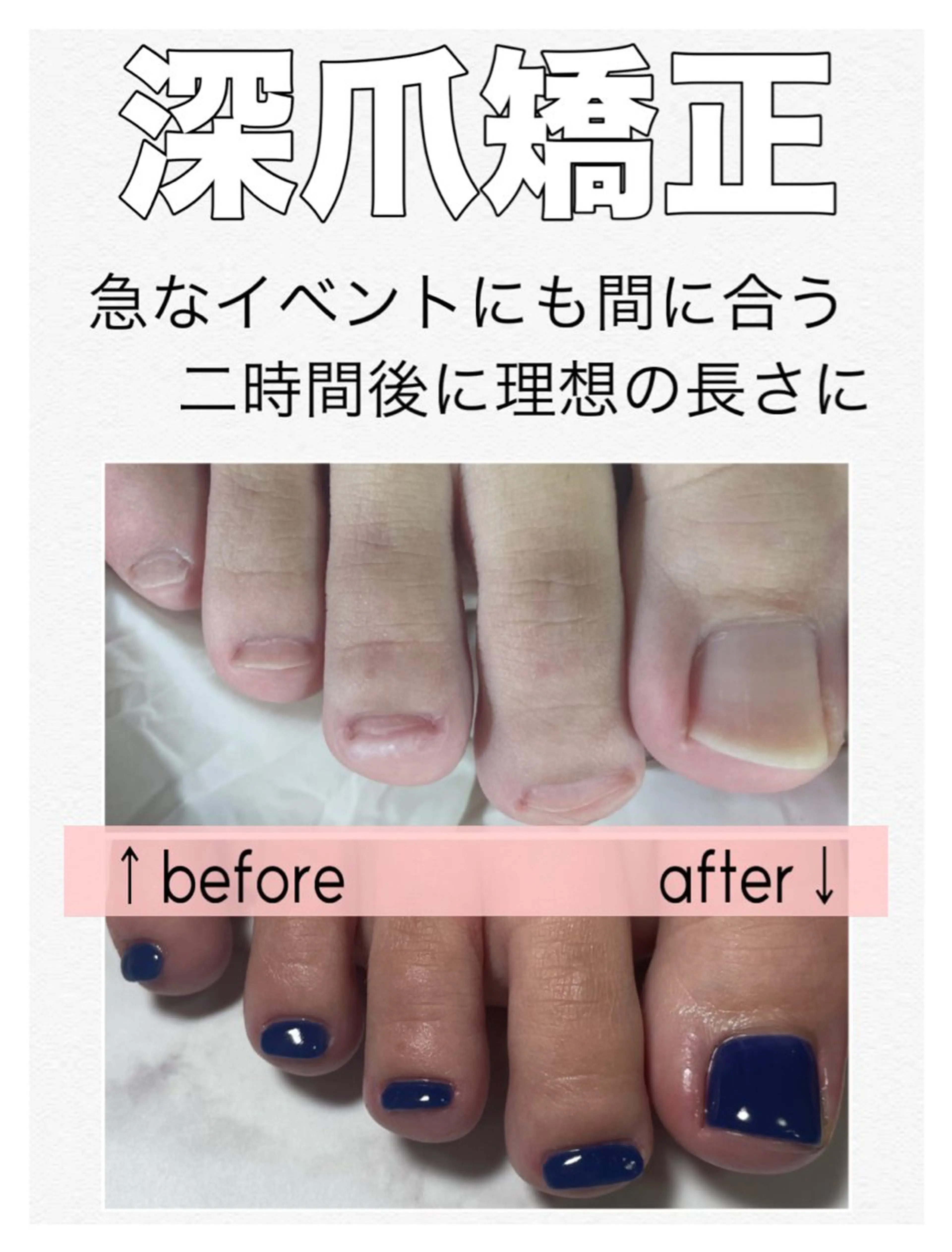 ネイル 長さ出し フットネイル nail salon petillantのネイルデザイン
