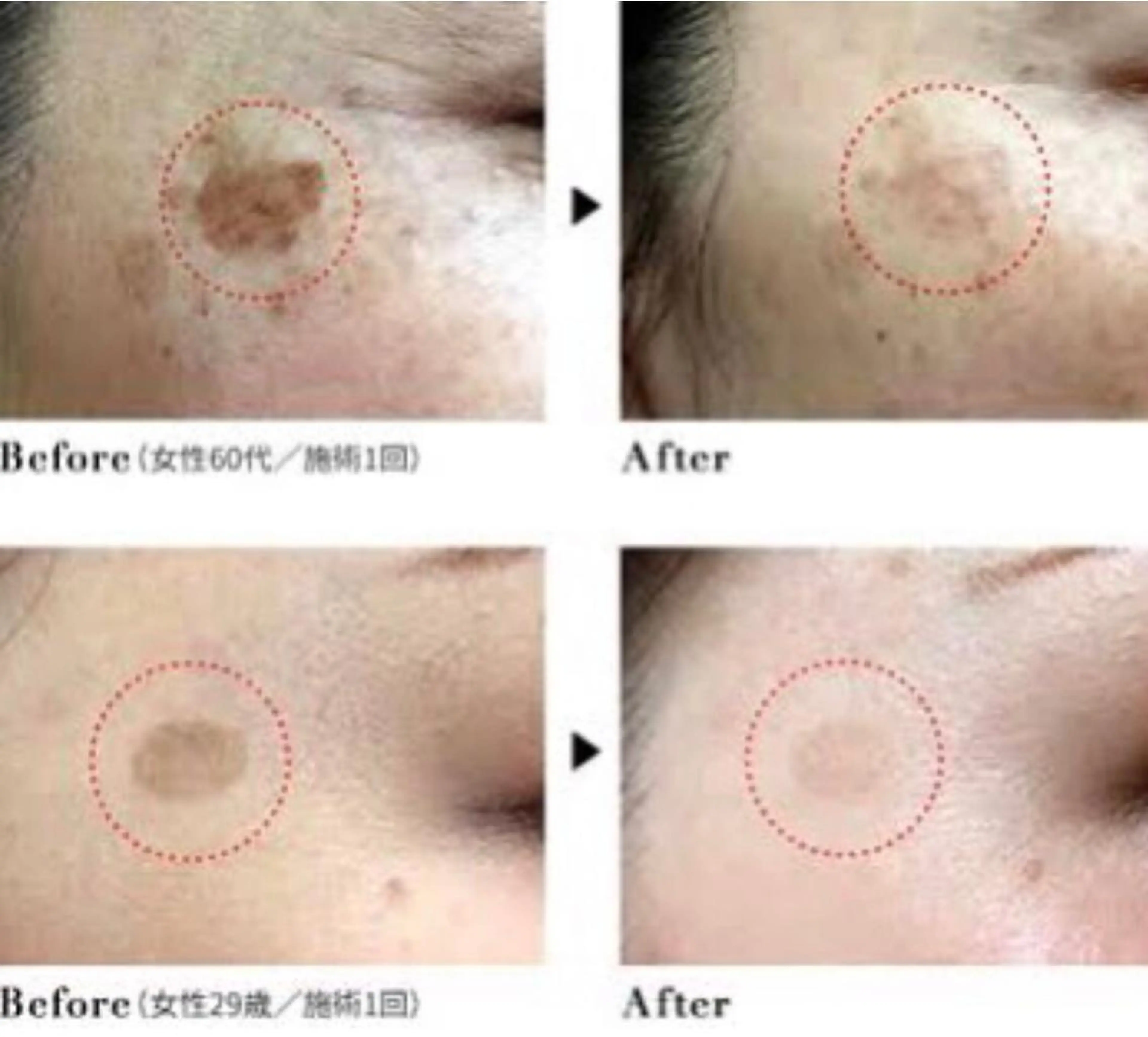 BestBelleꕤ 大阪福島/肌質改善のエステ・リラクイメージ