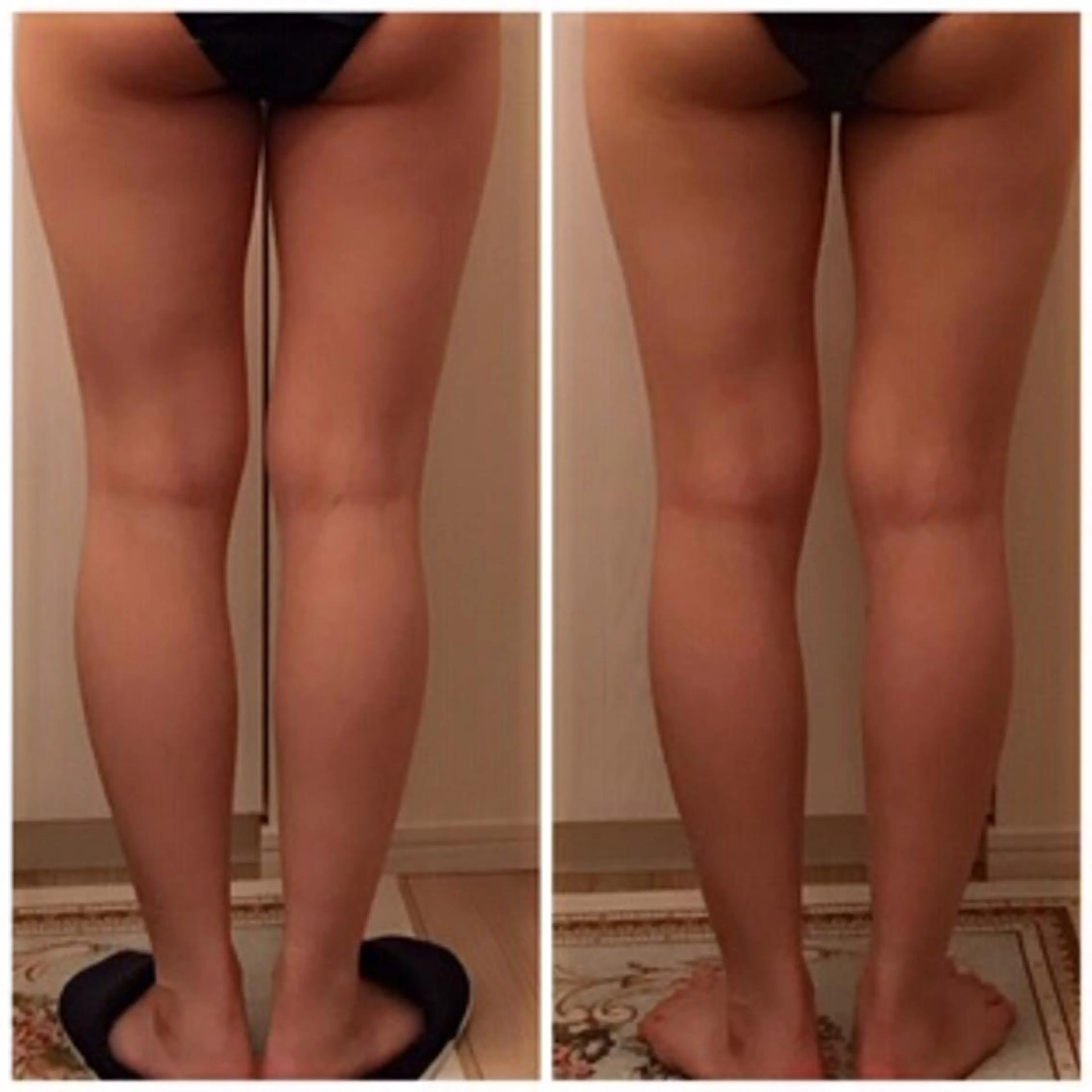 食べながら魅せボディ éclatJua川越のエステ・リラクイメージ