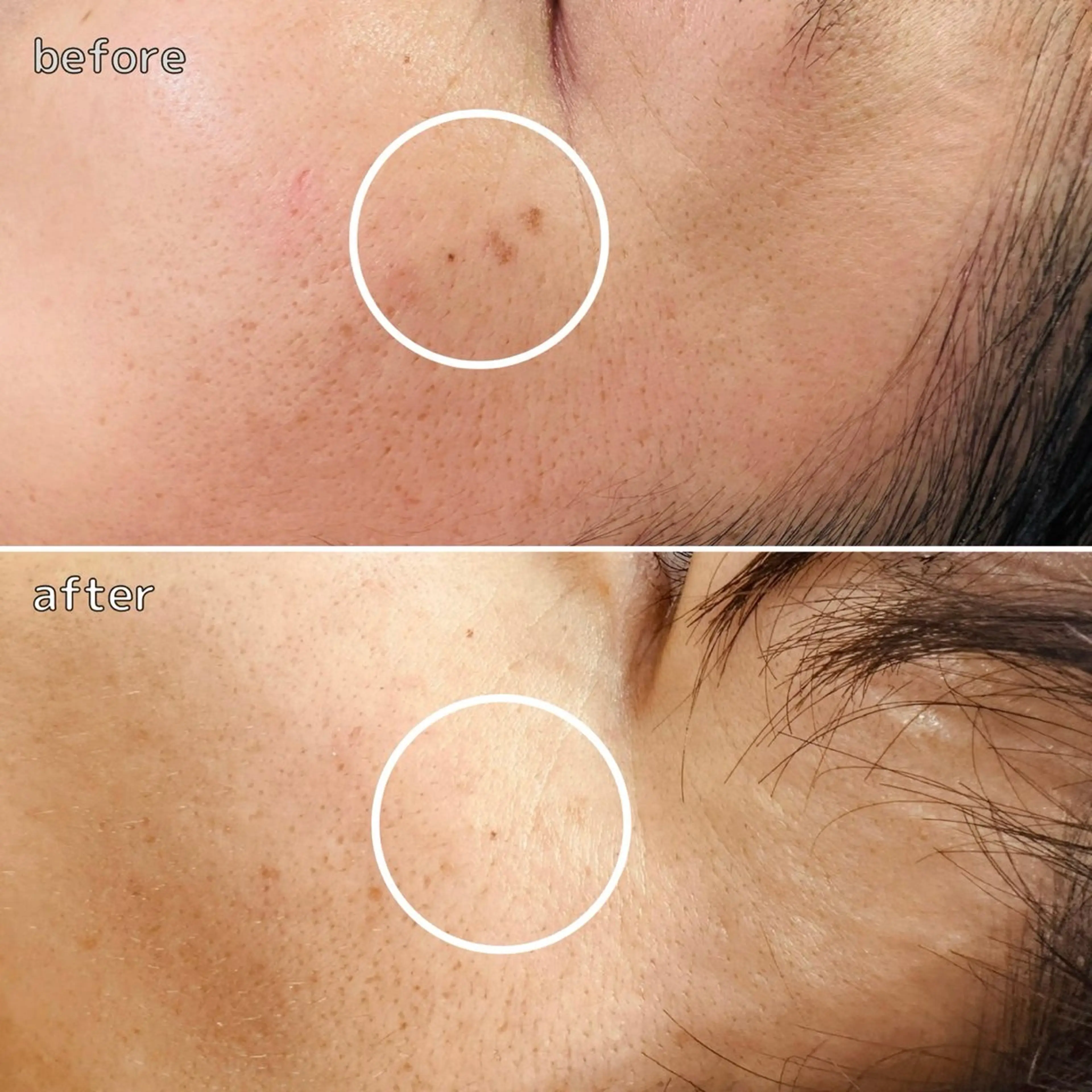 エステ 肌育・肌質改善サロン 🫧ニナル🫧のエステ・リラクイメージ