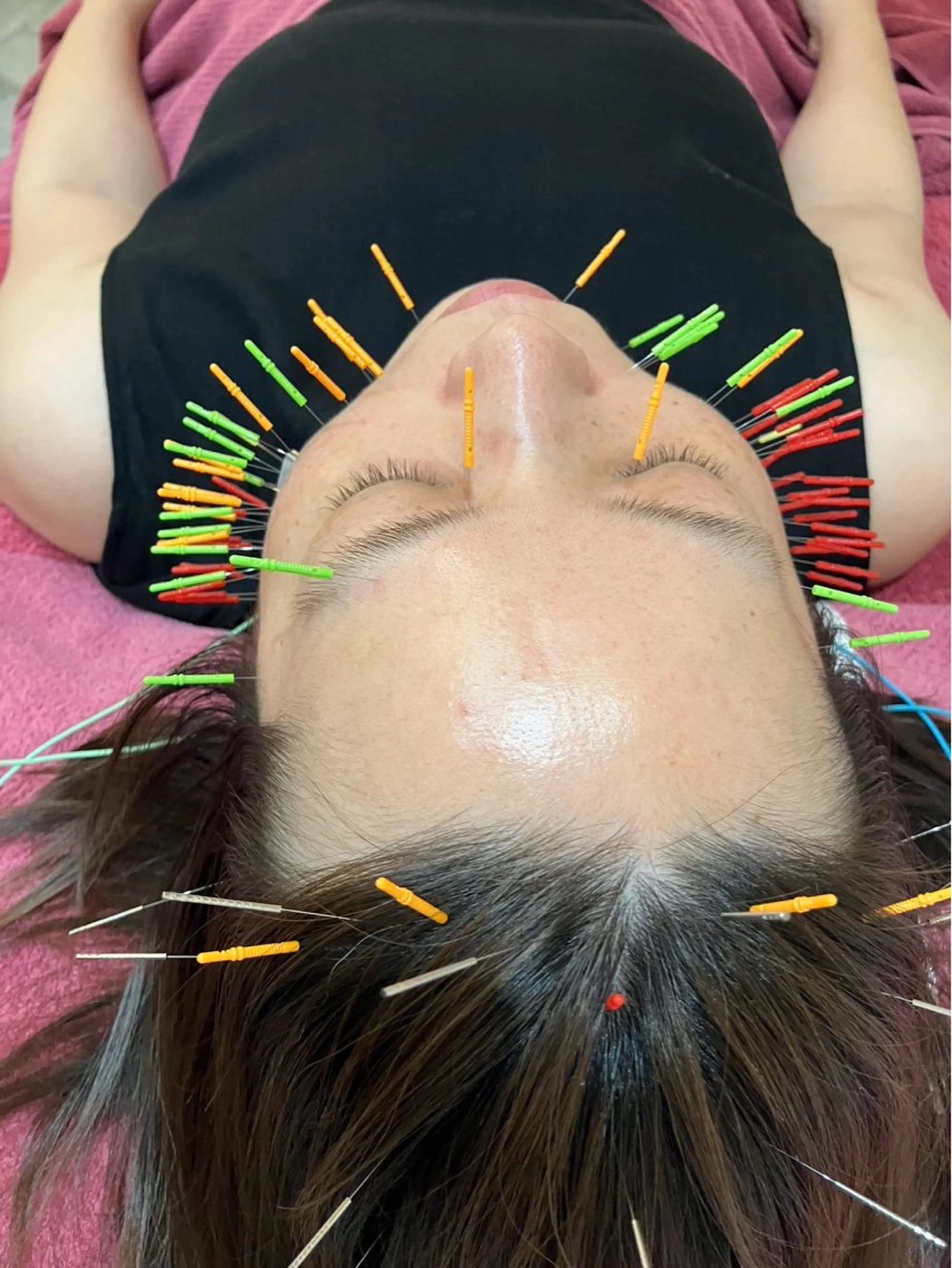 エステ リラク 美容鍼灸女性専用 りんご鍼灸治療院のその他イメージ