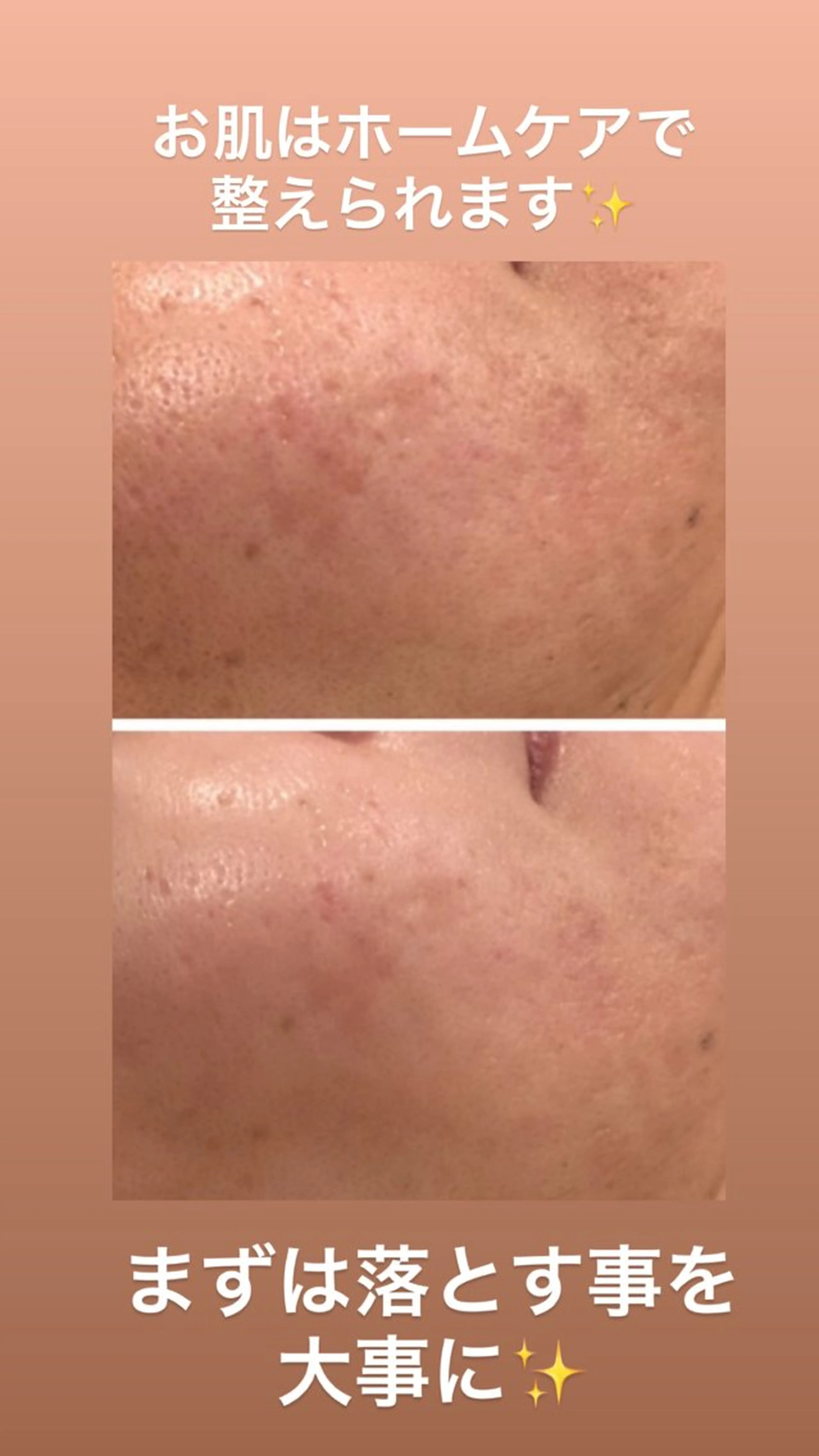 エステ 耳ツボ/体質改善/ 温活La mer月島のその他イメージ