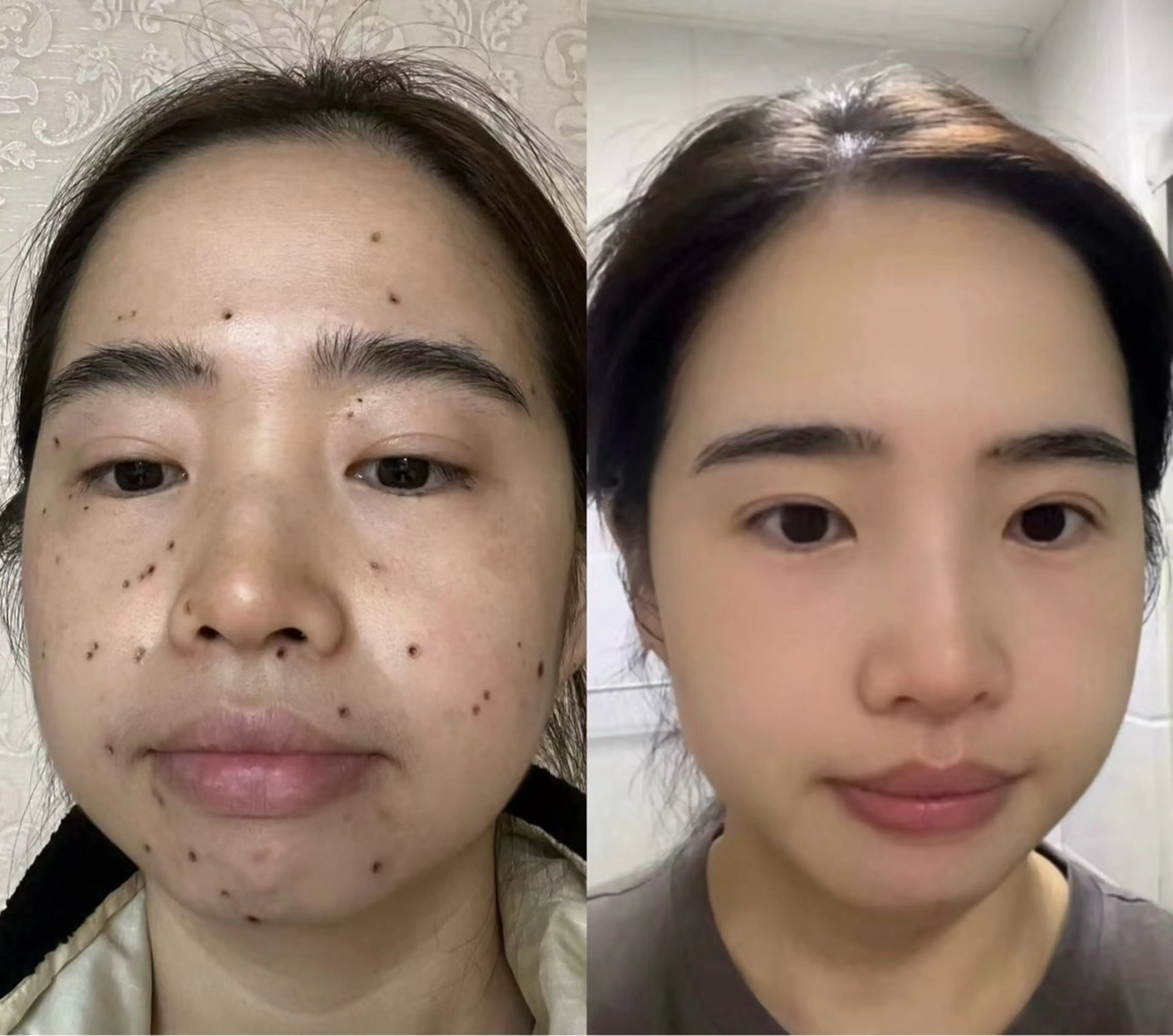 ビューティーリゾート麗所属・于 麗影のエステ・リラクイメージ