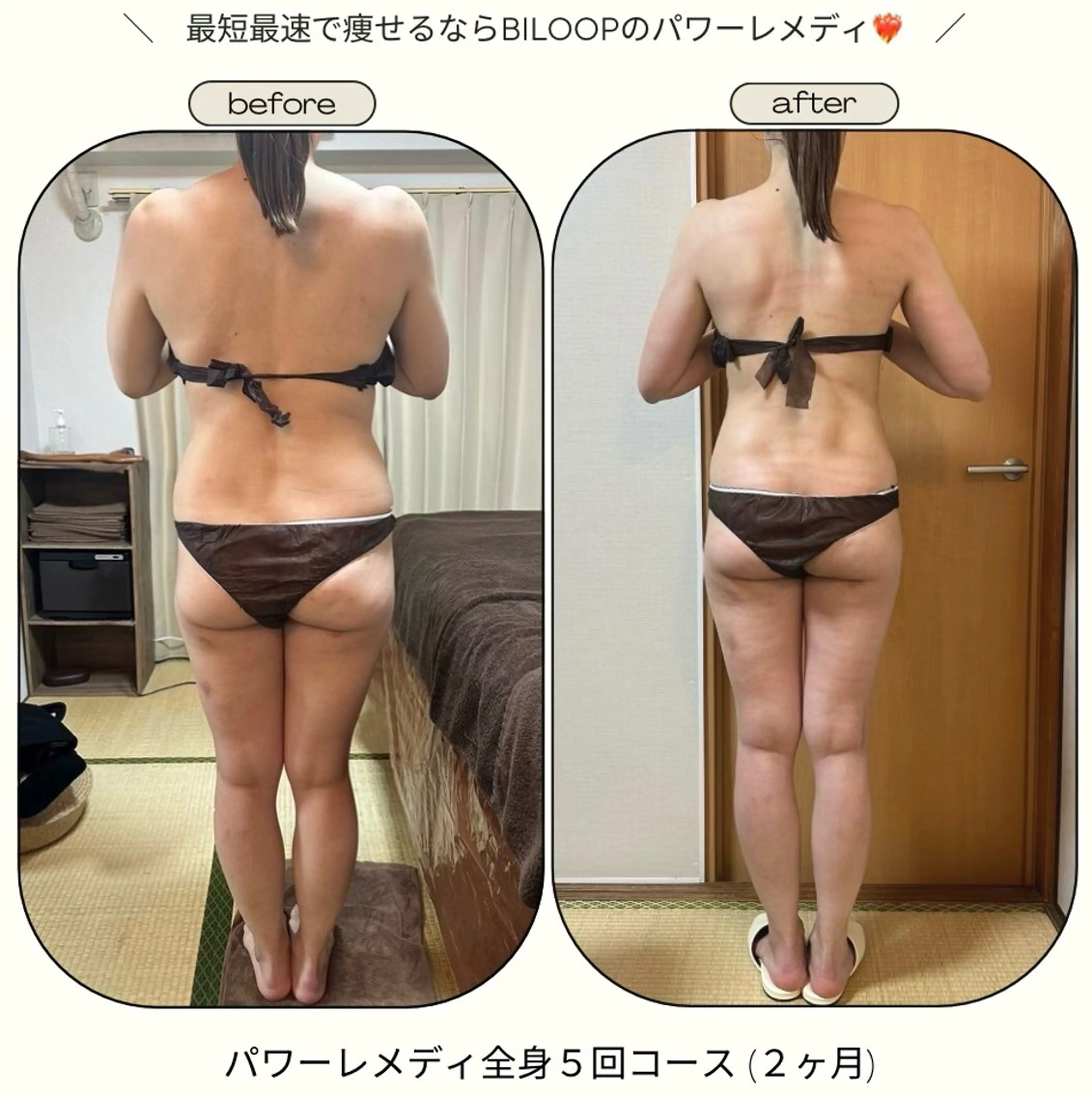 《本気痩せ×疲労改善 》  BILOOPのエステ・リラクイメージ