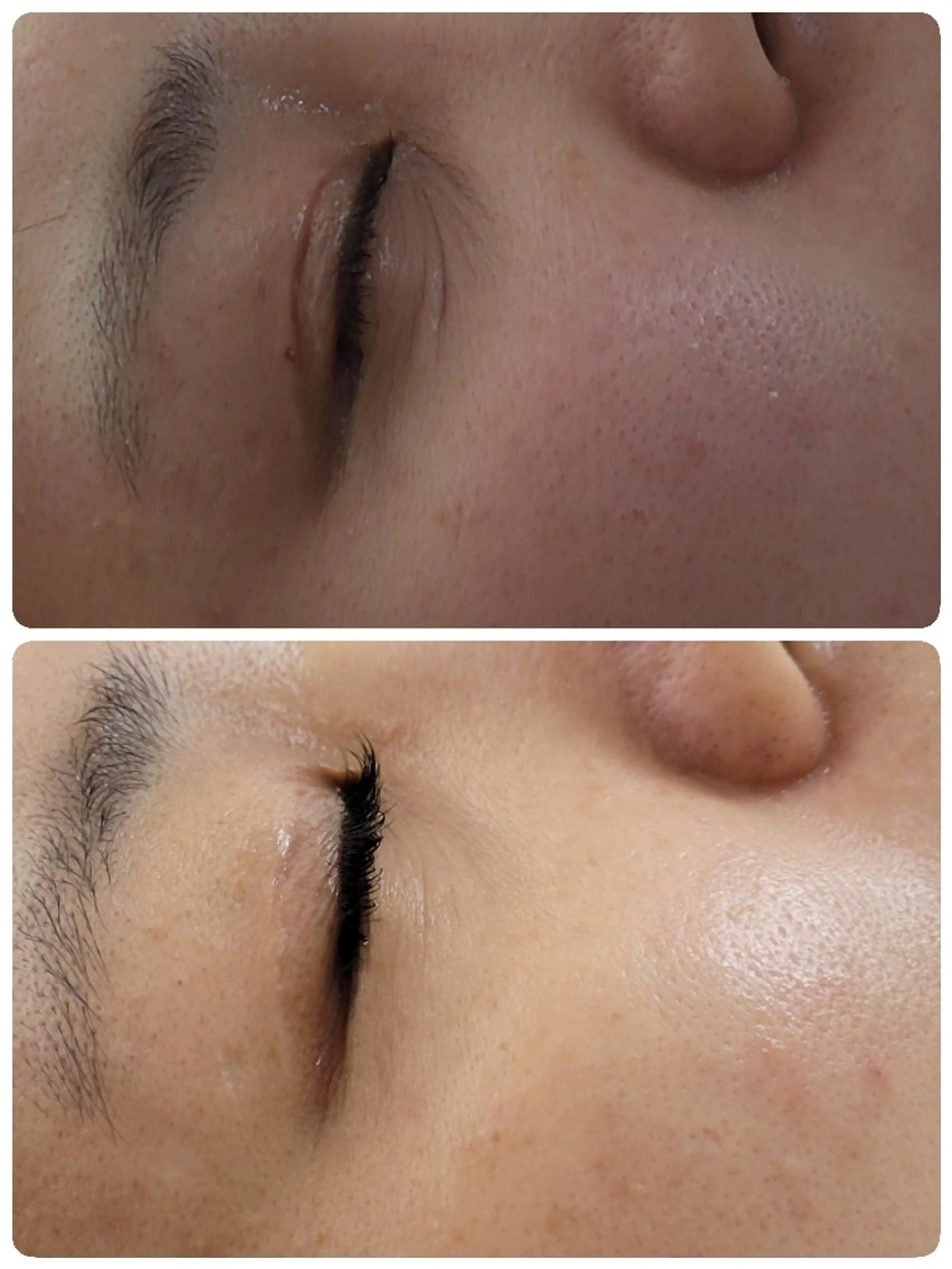 〈ニキビケアサロン〉 レゾン京橋店/ 浅川のエステ・リラクイメージ